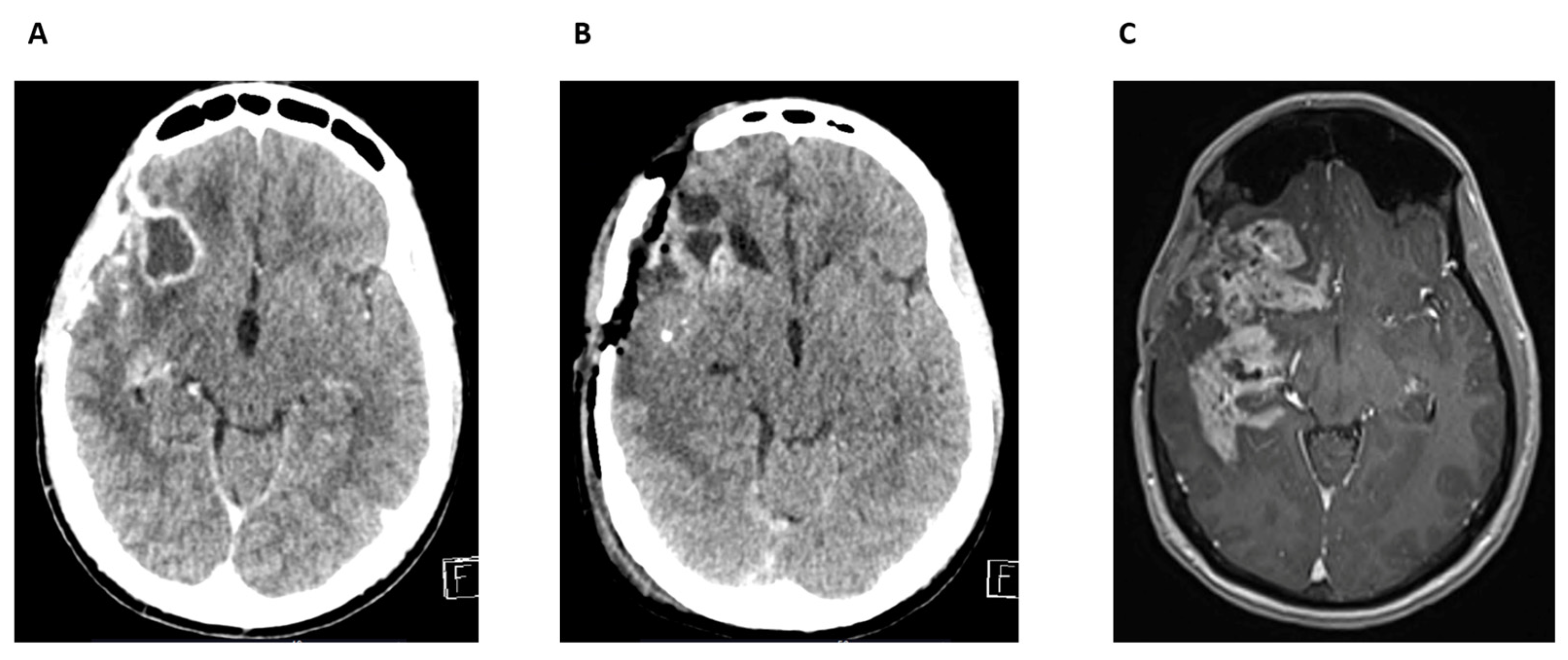 Cancers 17 01348 g008