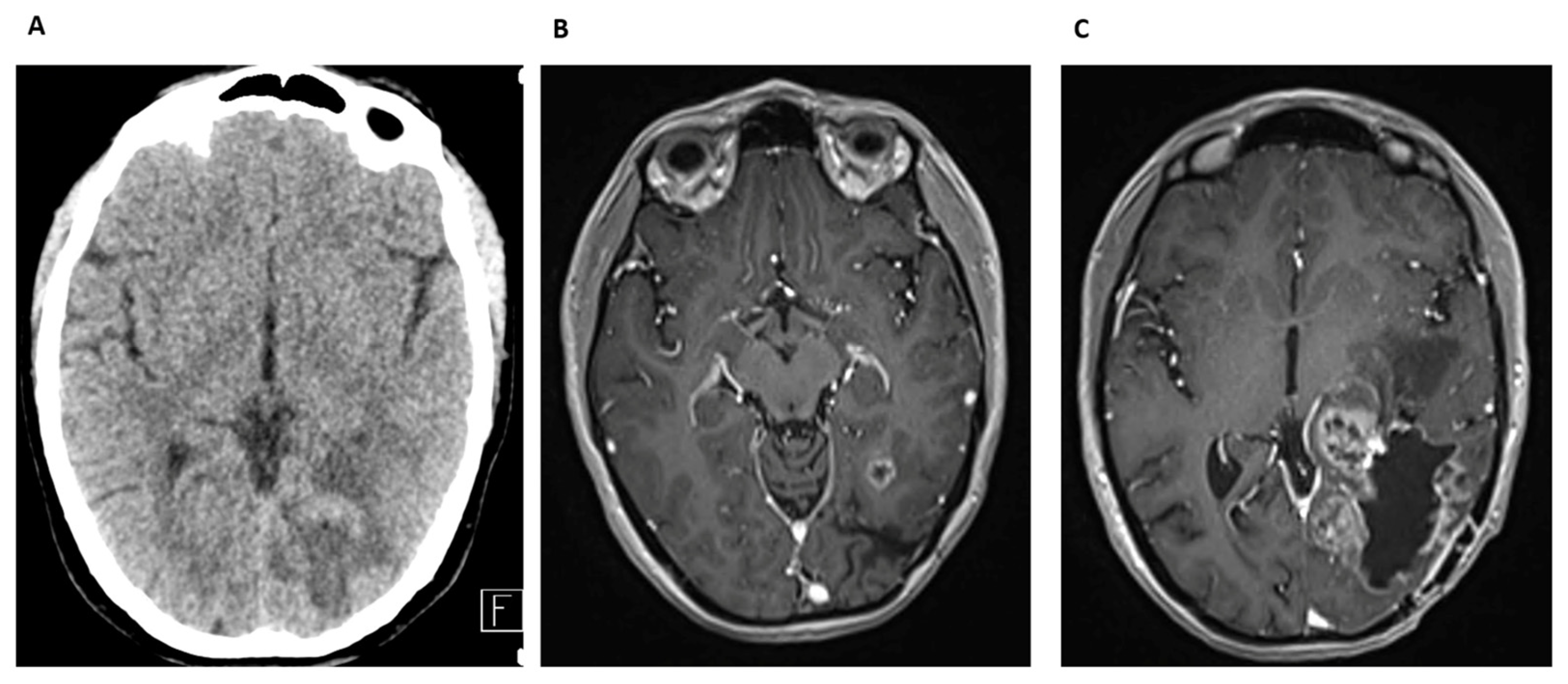 Cancers 17 01348 g009