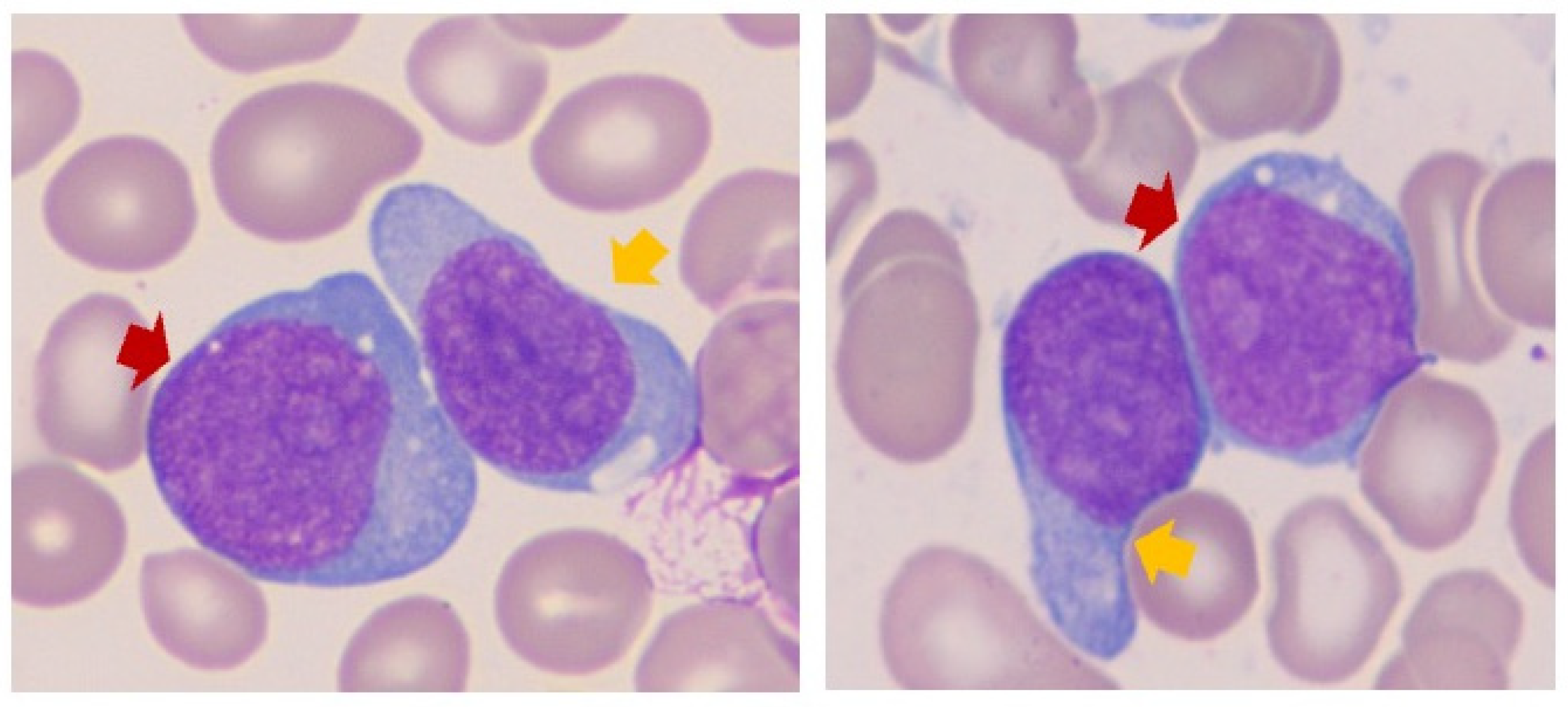 Cancers 17 01354 g001