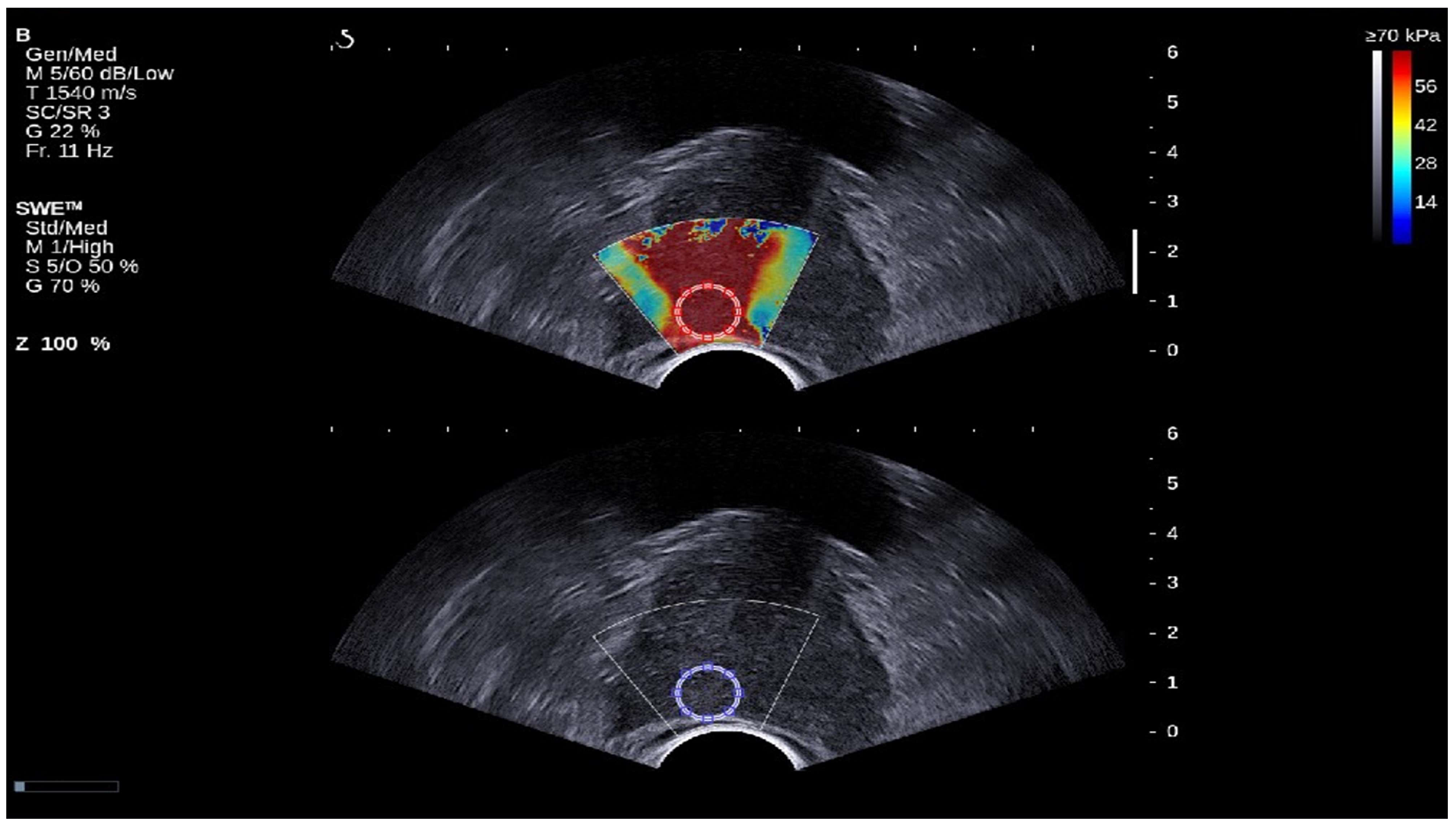 Cancers 17 01358 g001