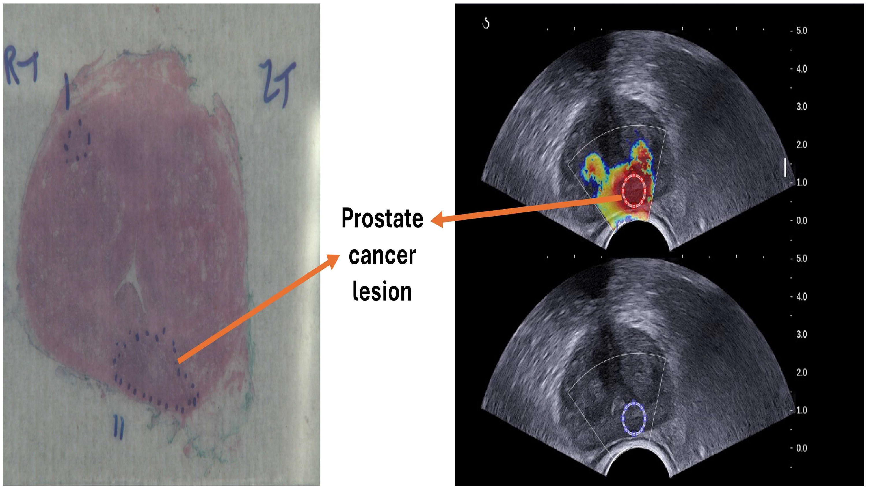 Cancers 17 01358 g002