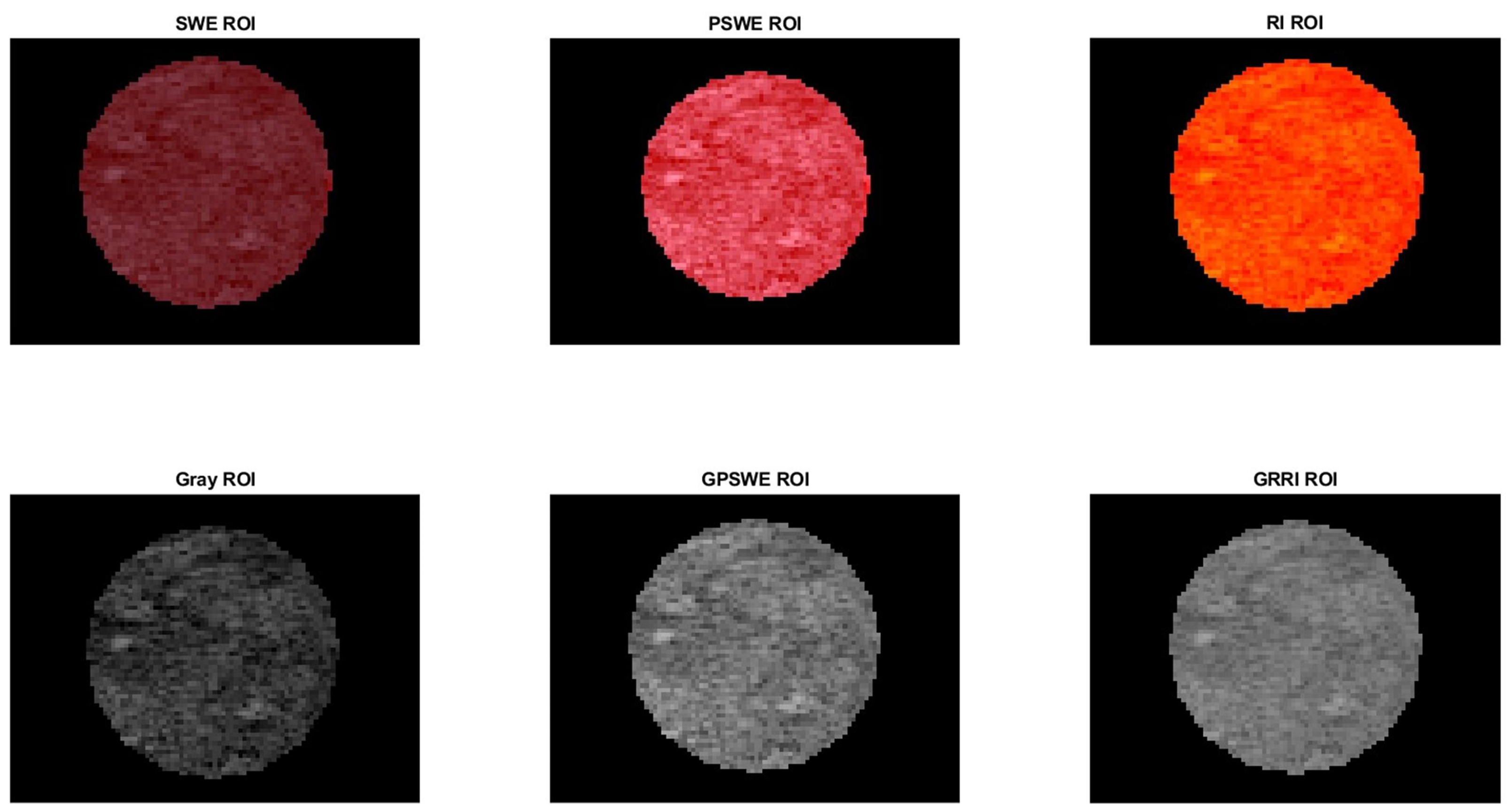 Cancers 17 01358 g004