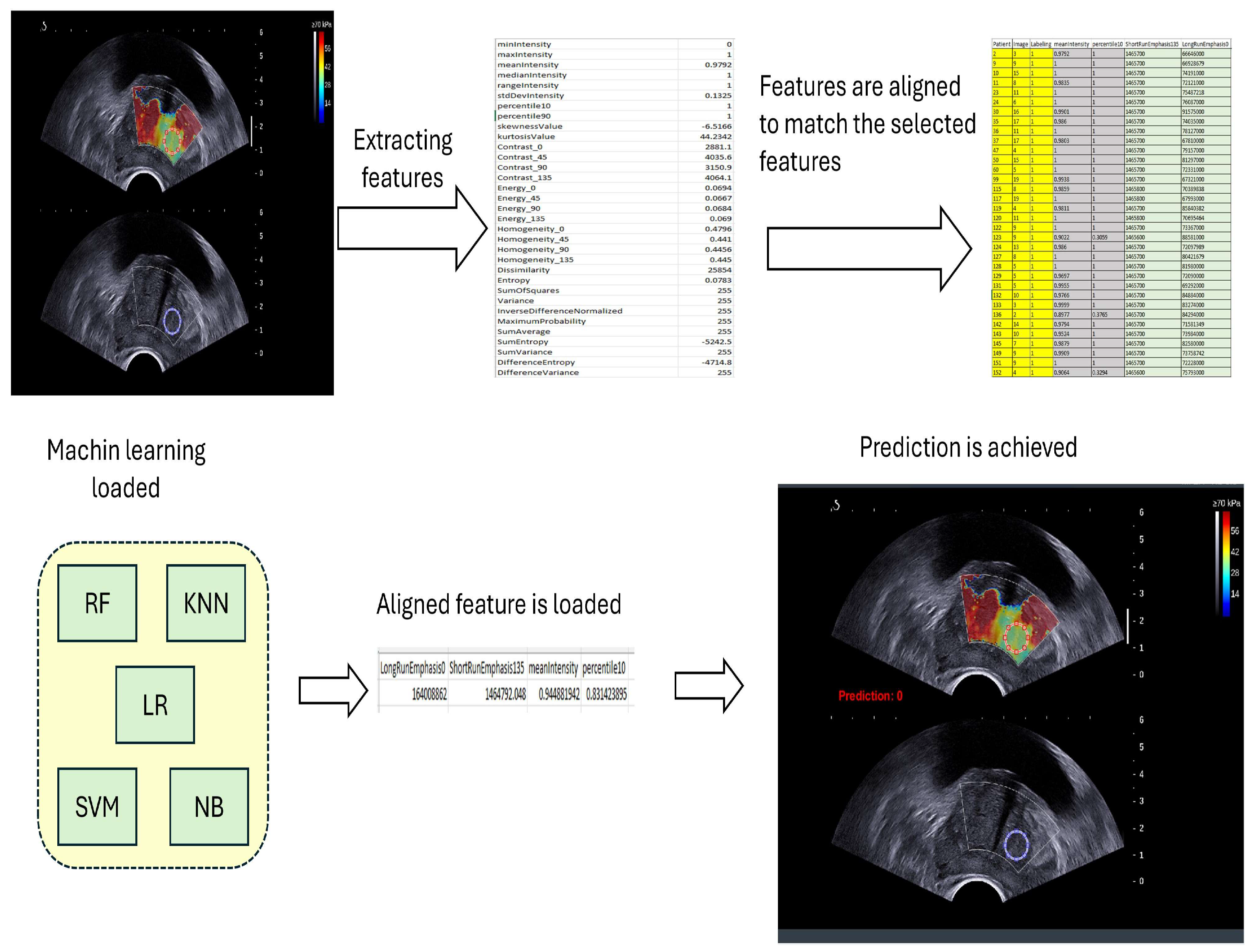 Cancers 17 01358 g005