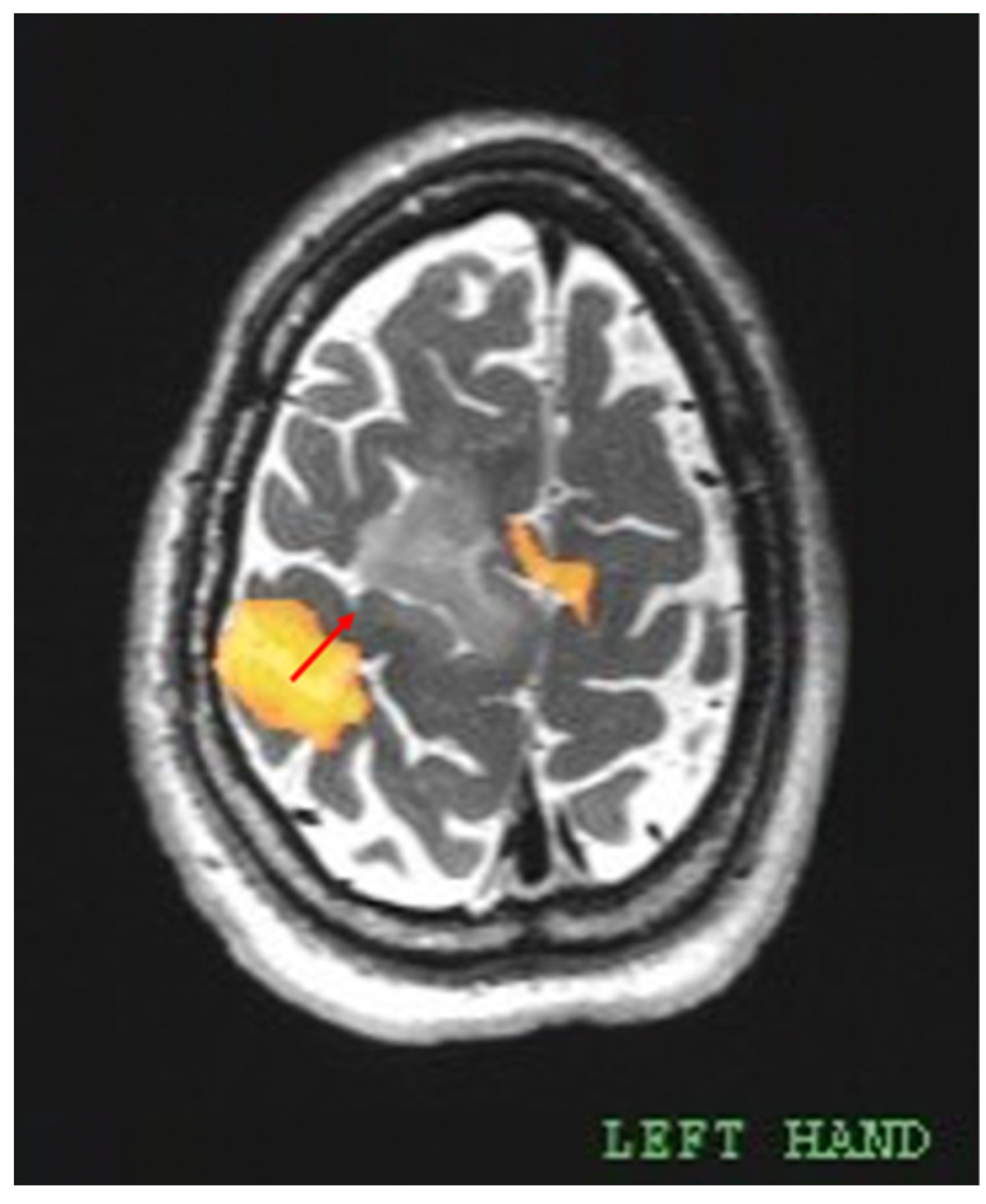 Cancers 17 01369 g002