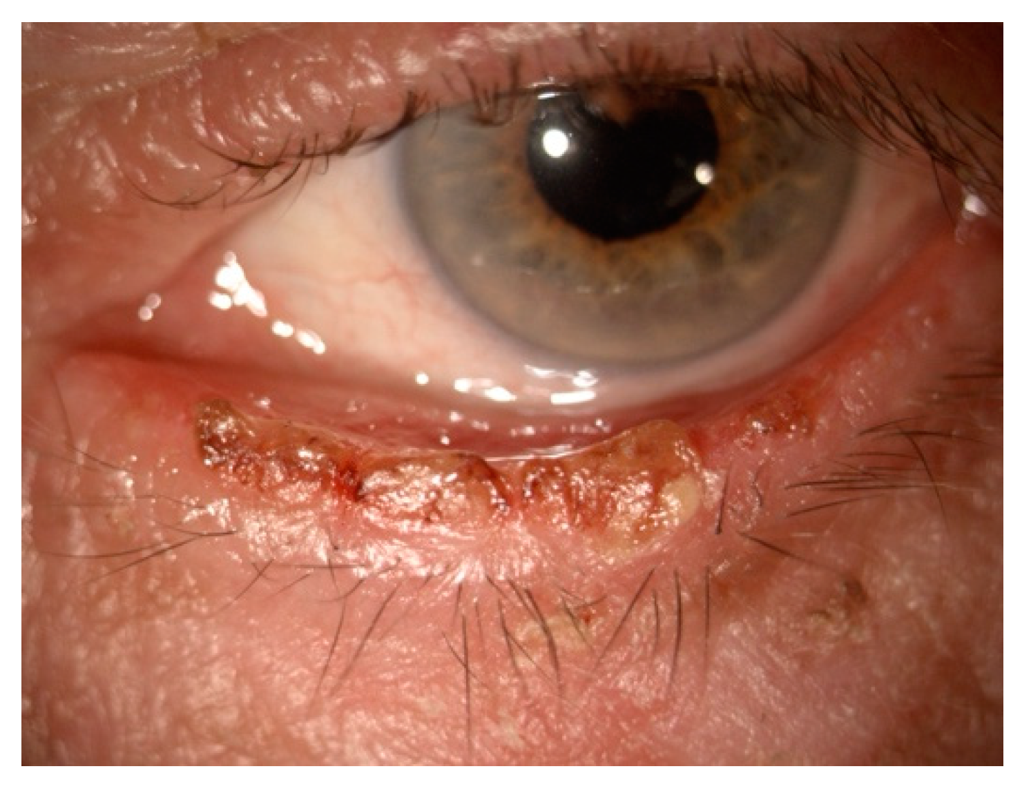 Cancers 17 01384 g002