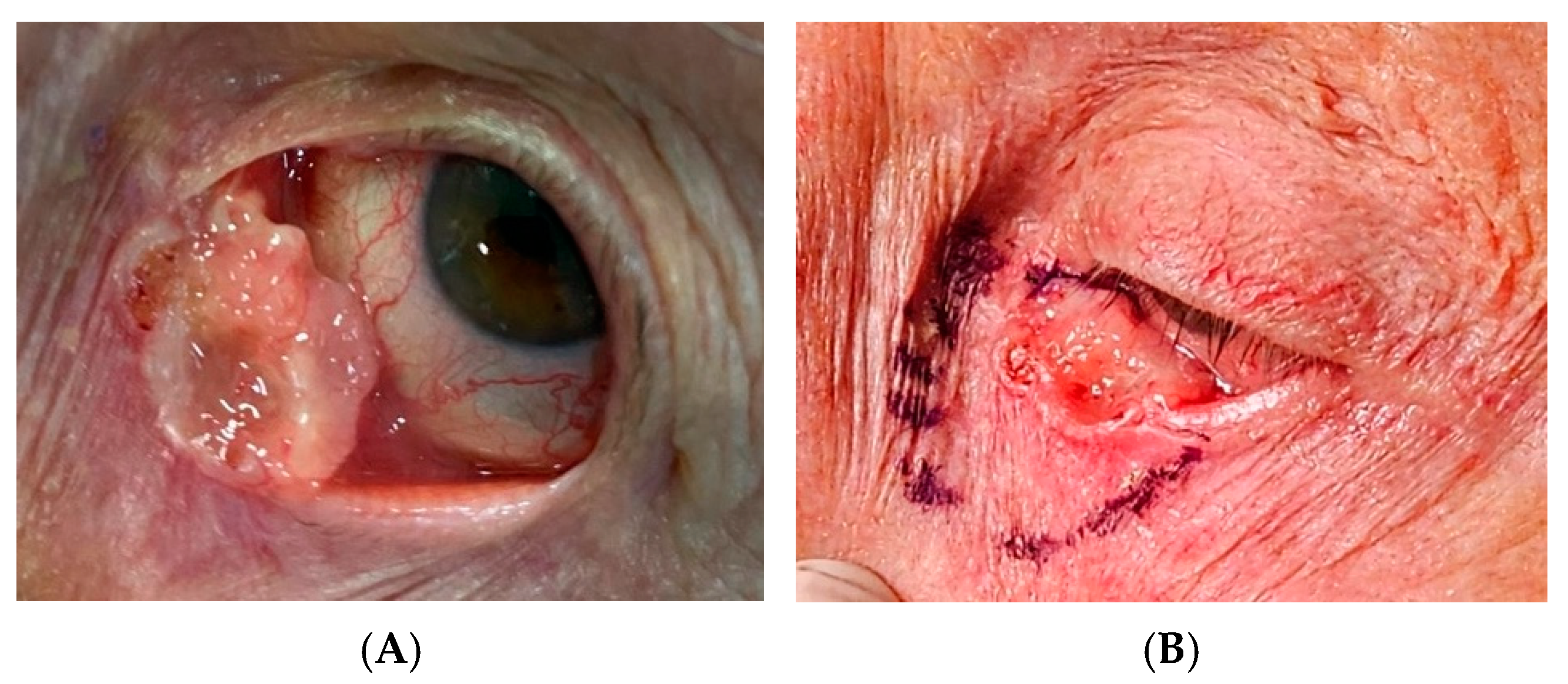 Cancers 17 01384 g003