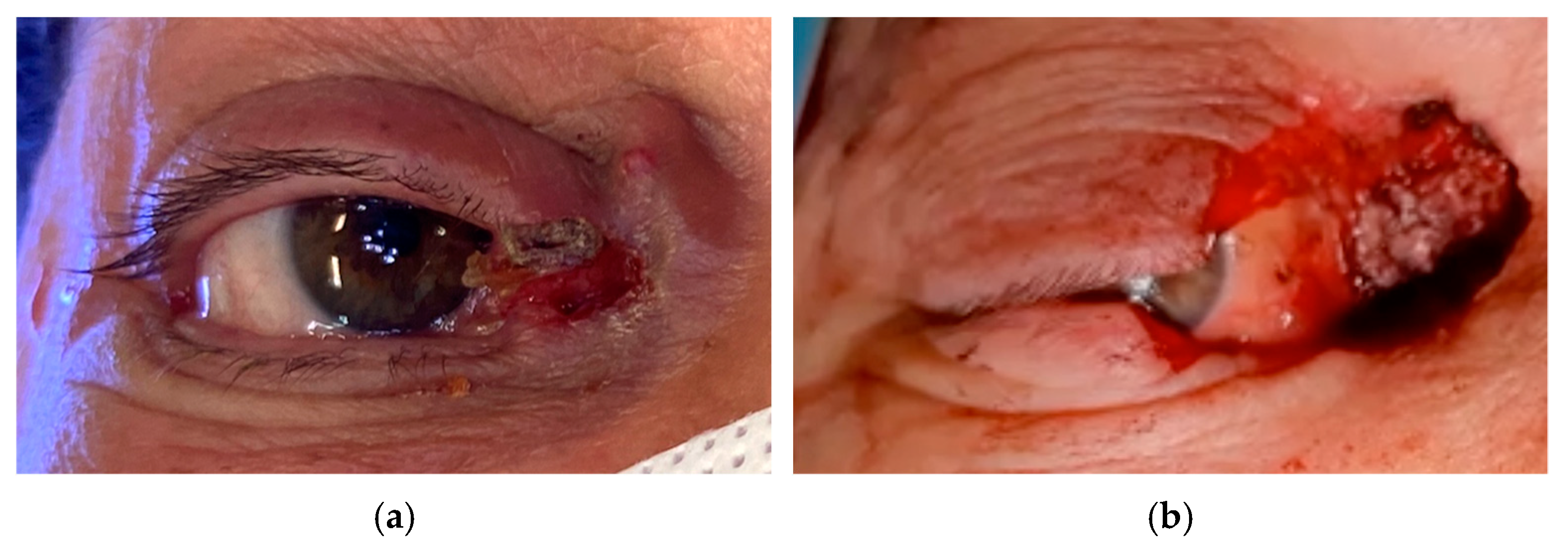 Cancers 17 01384 g004