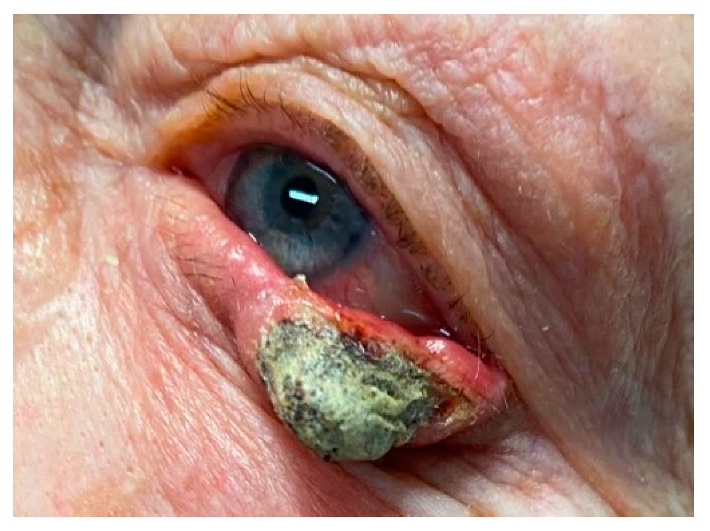 Cancers 17 01384 g005