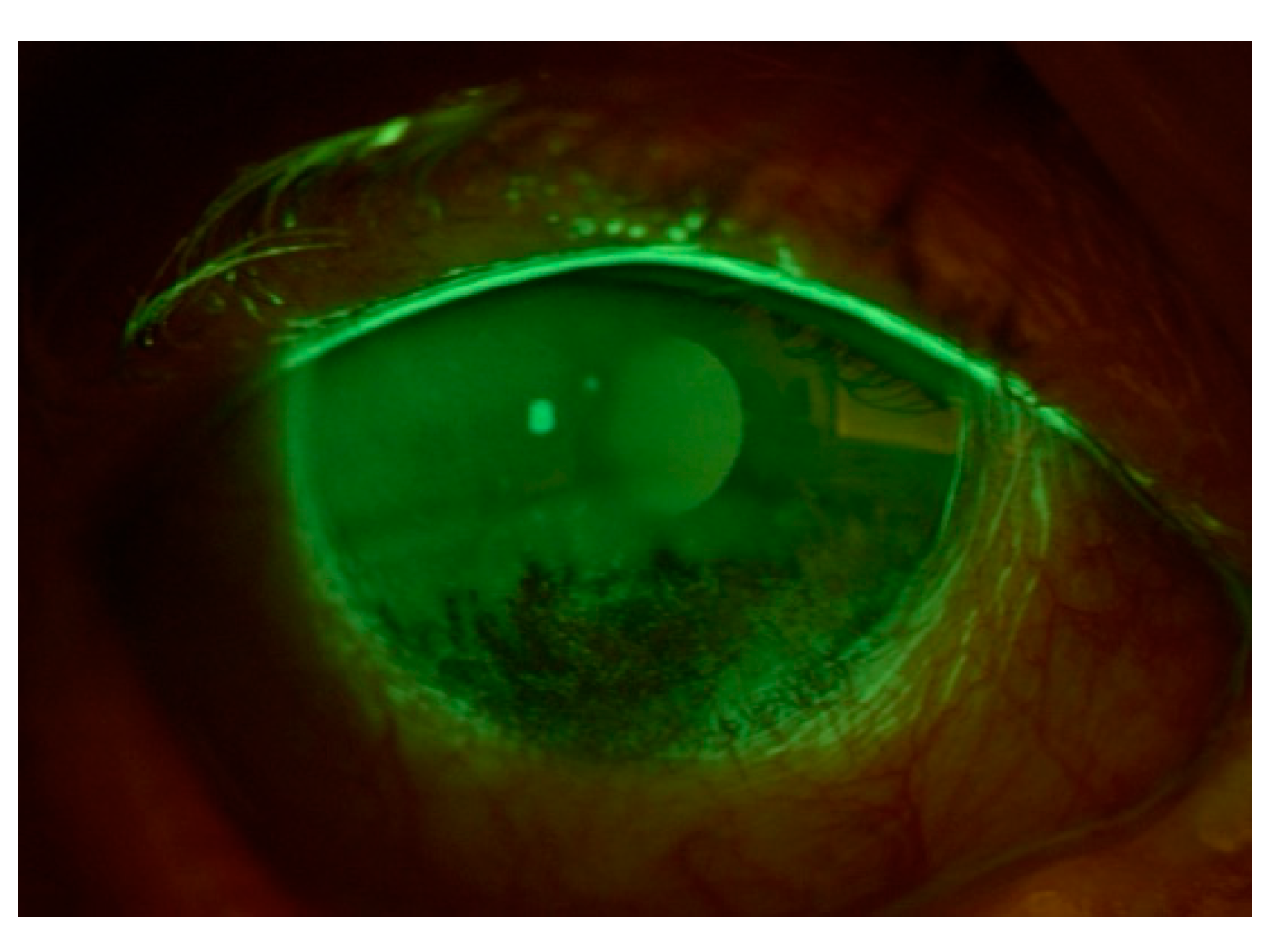 Cancers 17 01384 g006