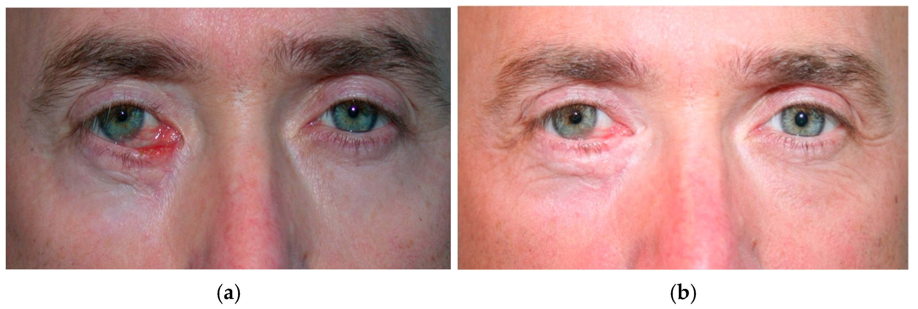 Cancers 17 01384 g007