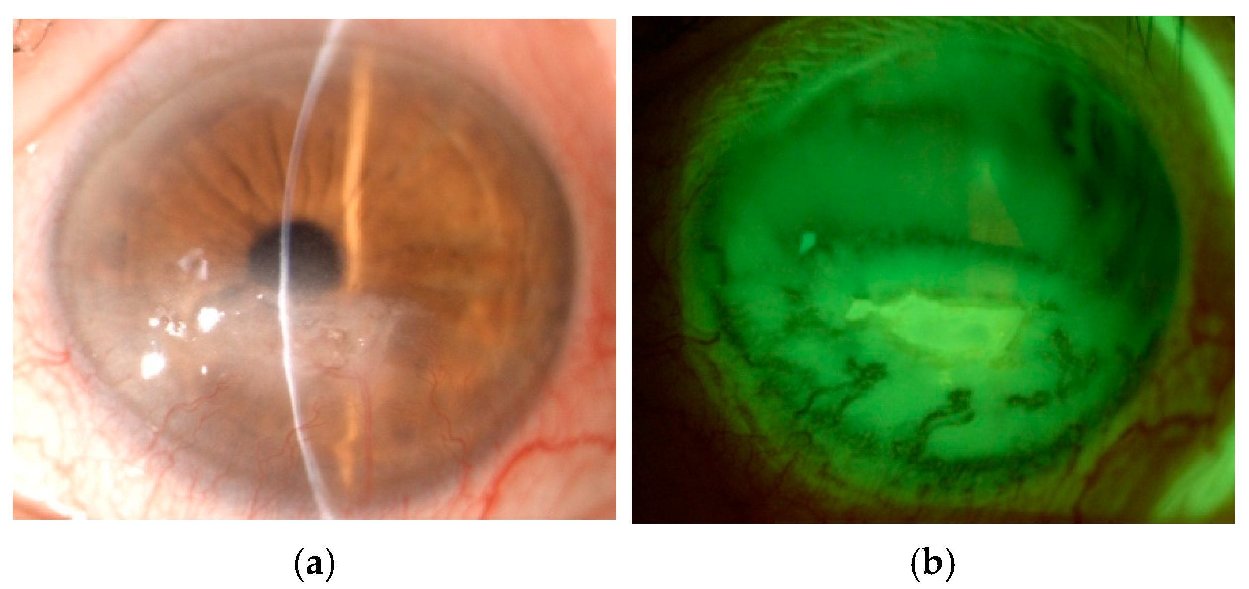 Cancers 17 01384 g009