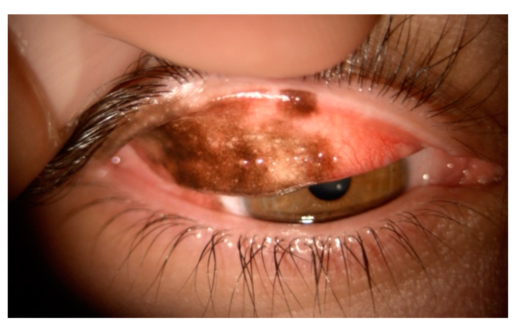 Cancers 17 01384 g010