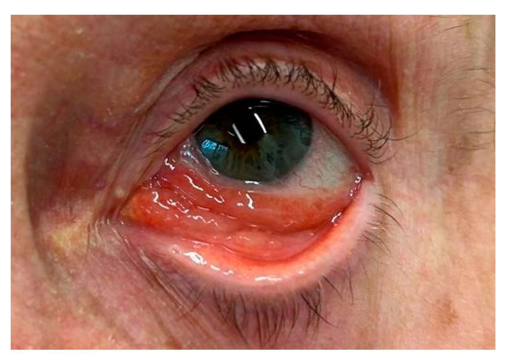 Cancers 17 01384 g011