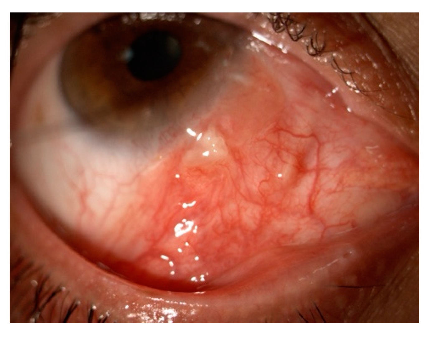 Cancers 17 01384 g013