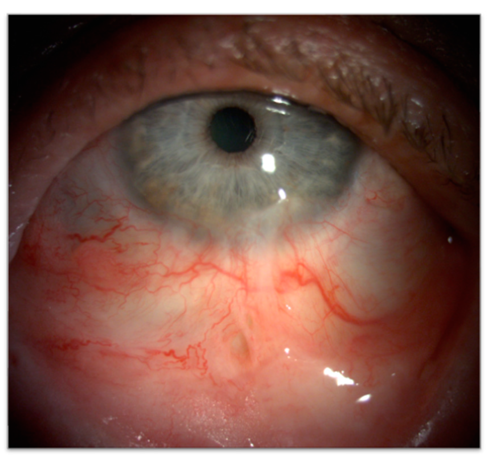 Cancers 17 01384 g014