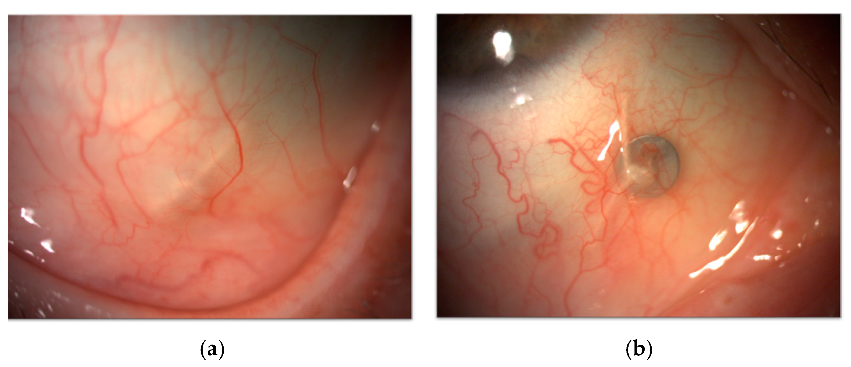 Cancers 17 01384 g015