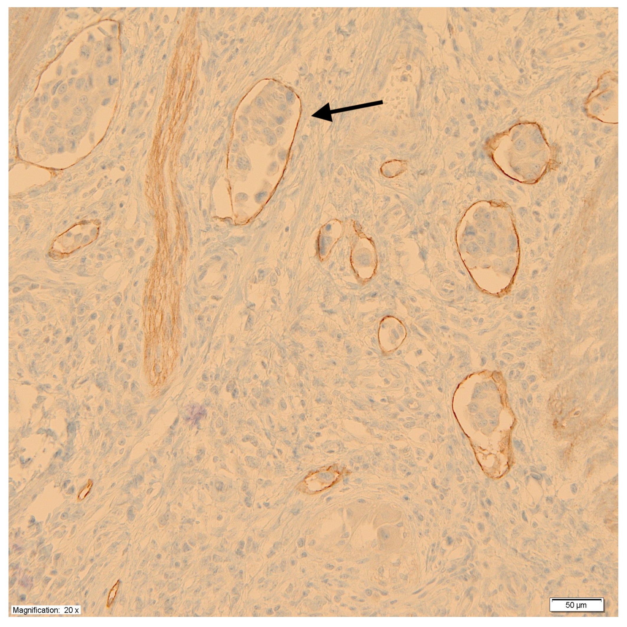 Cancers 17 01406 g002