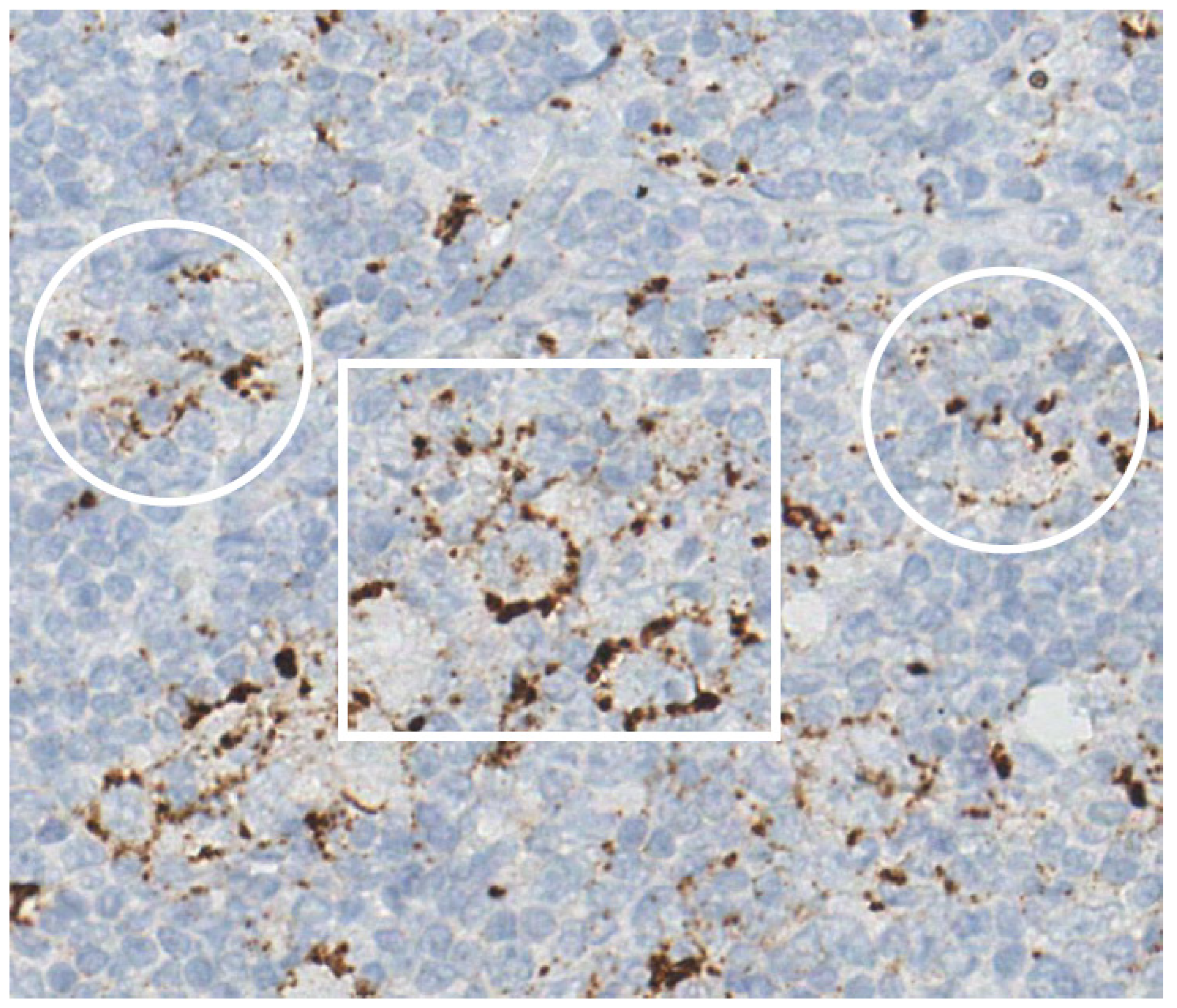 Cancers 17 01433 g003