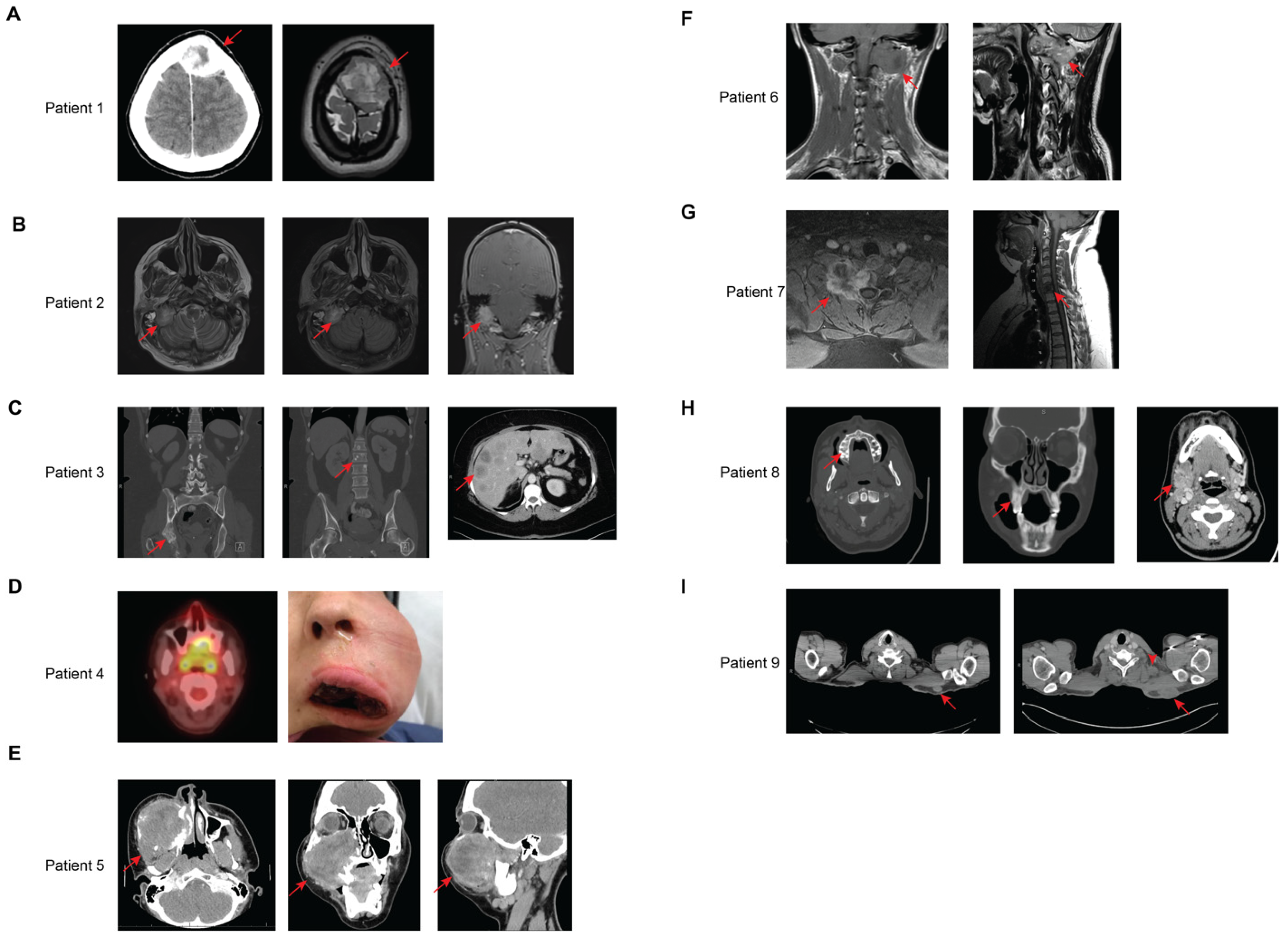 Cancers 17 01441 g003