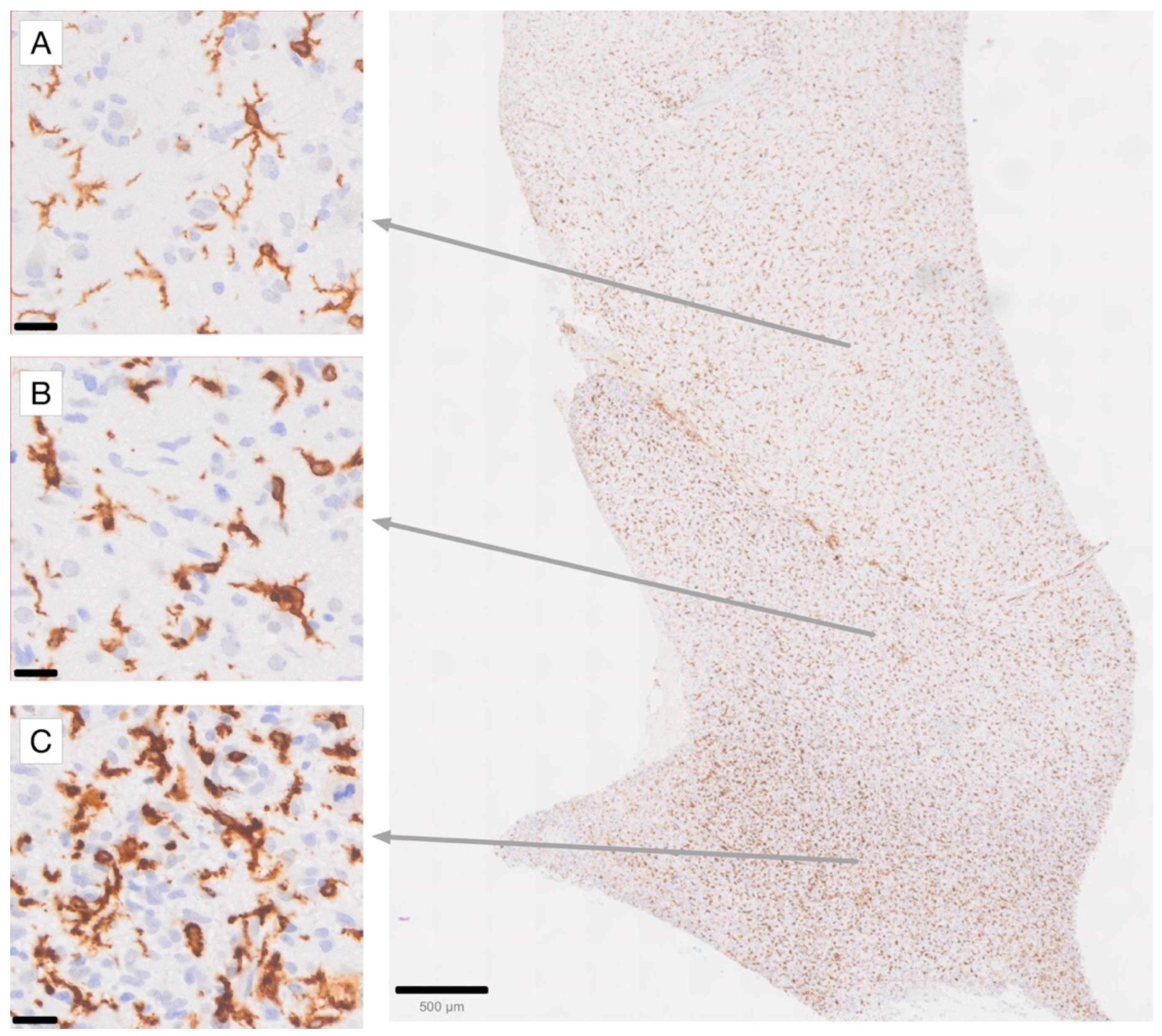 Cancers 17 01457 g001 Cancers 17 01457 g001