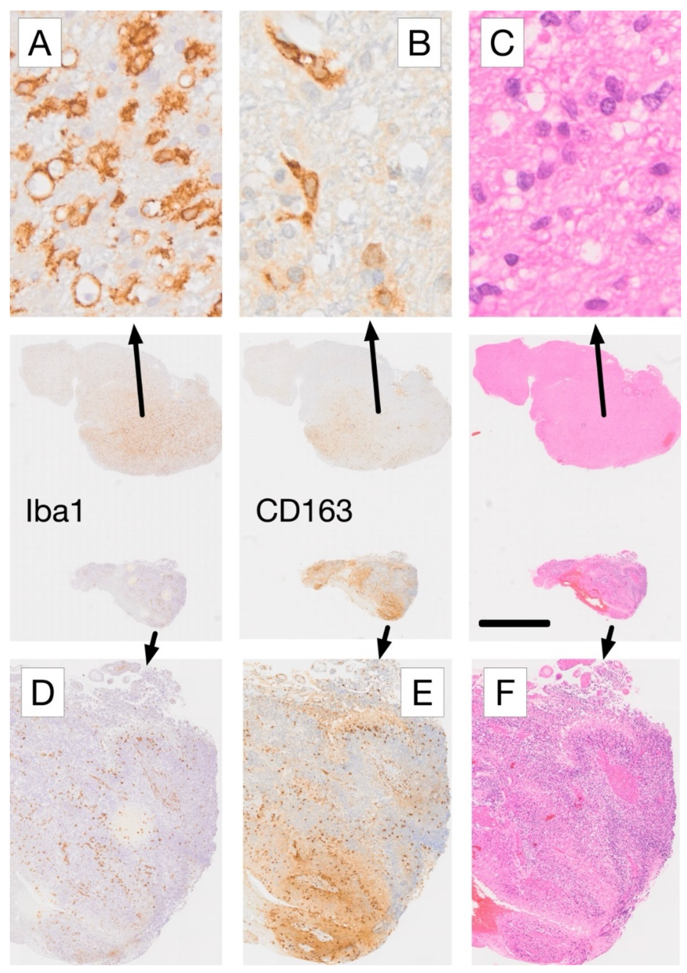 Cancers 17 01457 g003 Cancers 17 01457 g003