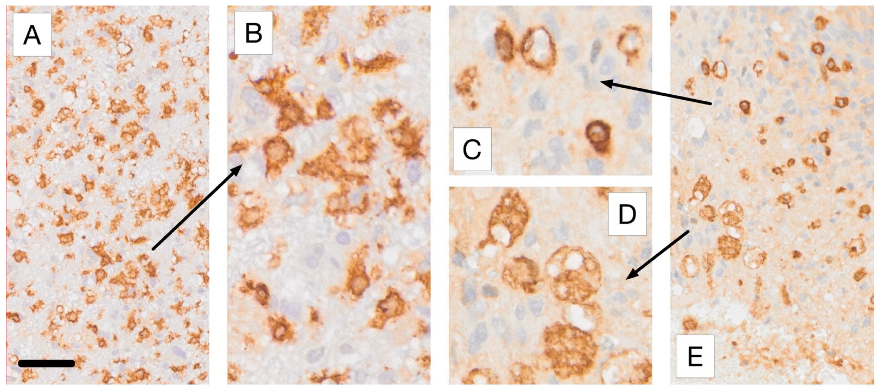 Cancers 17 01457 g004 Cancers 17 01457 g004