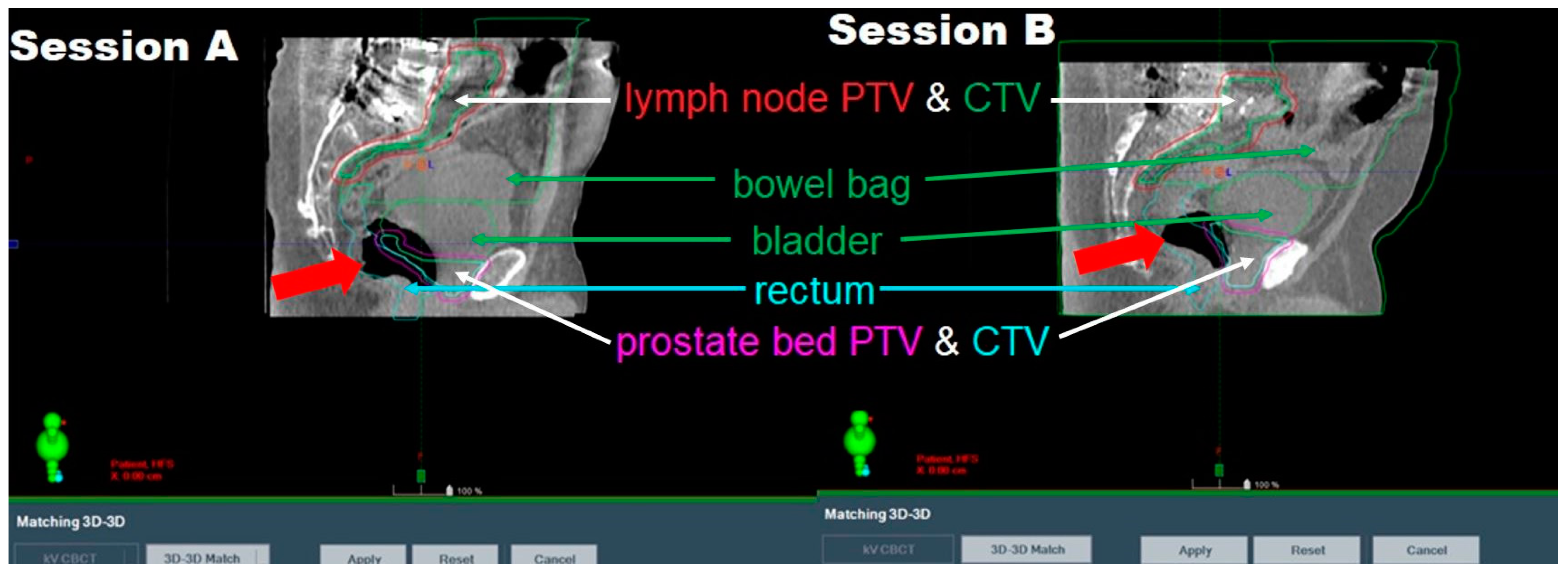 Cancers 17 01462 g002