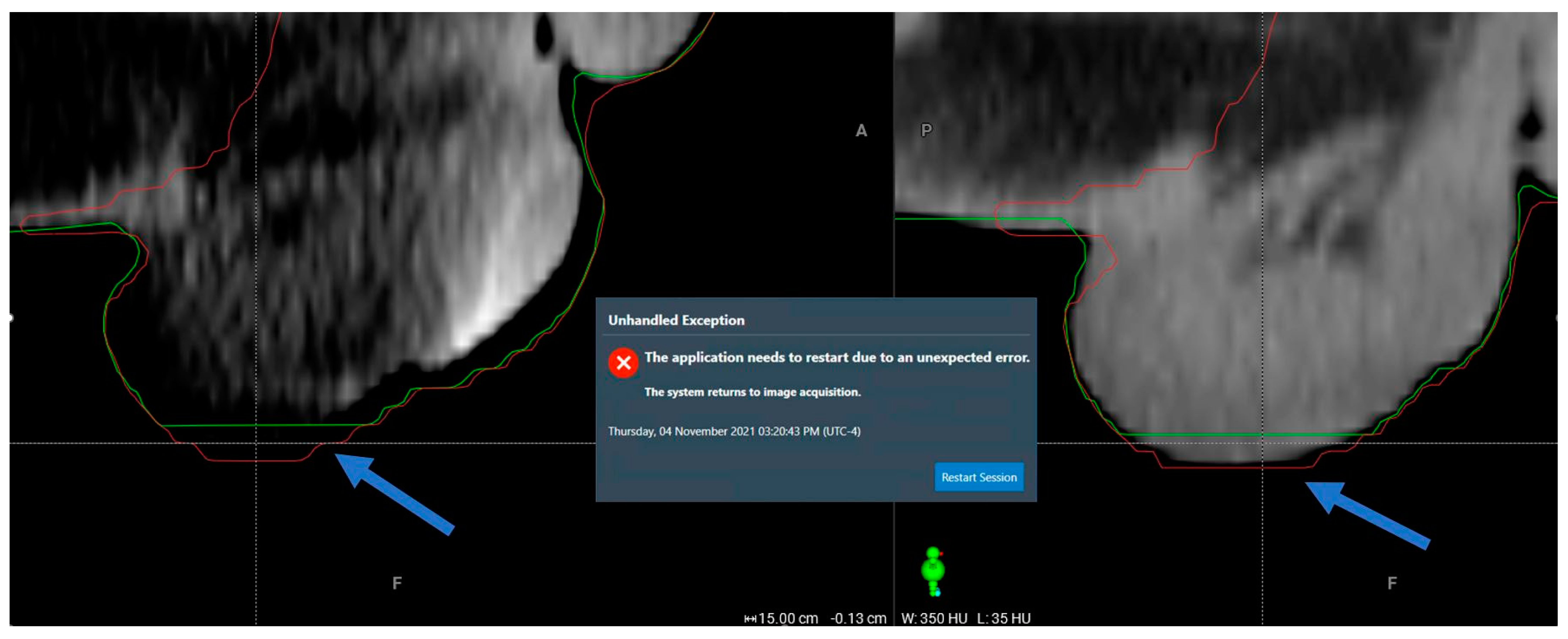 Cancers 17 01462 g003
