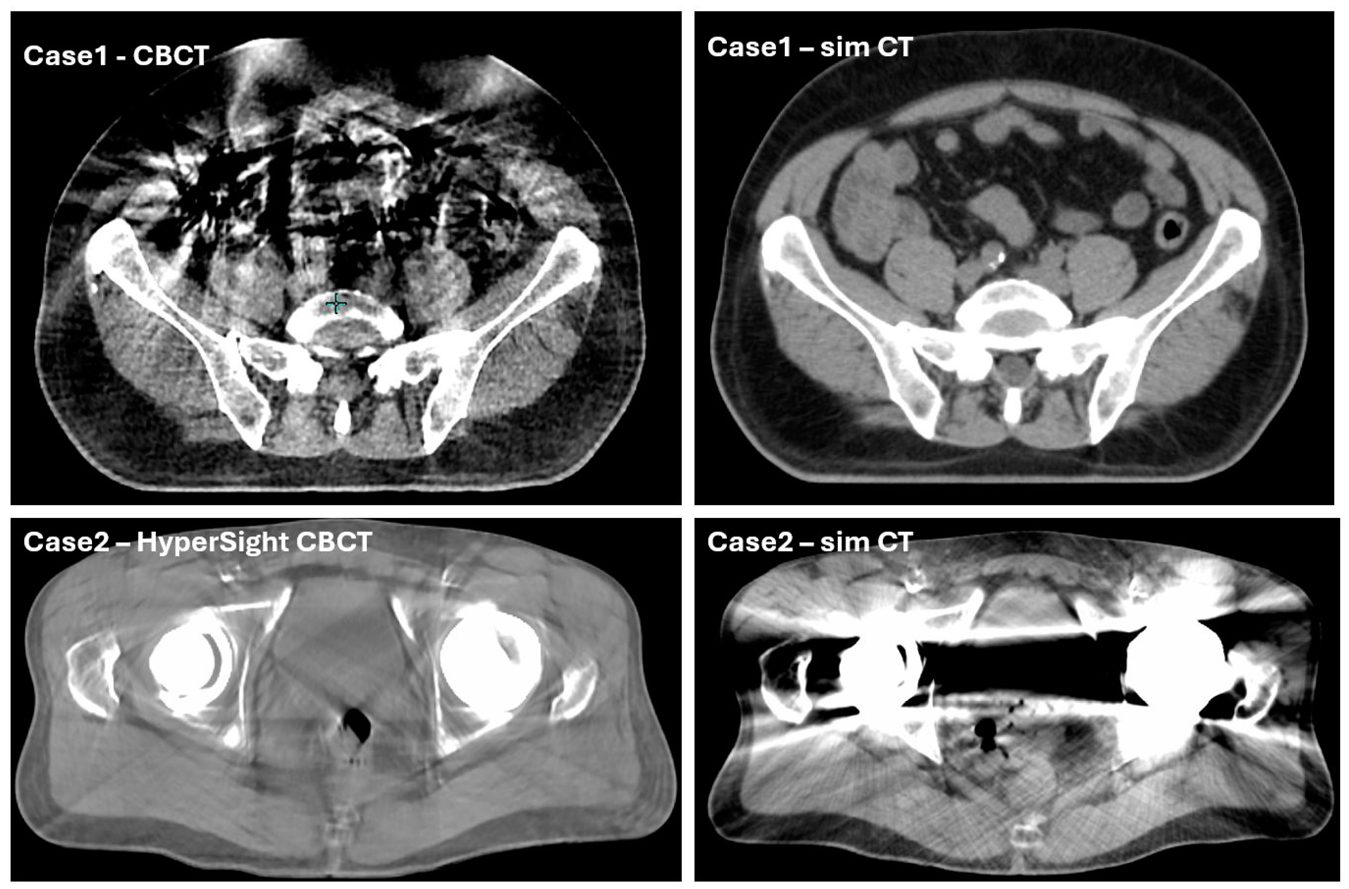 Cancers 17 01462 g005