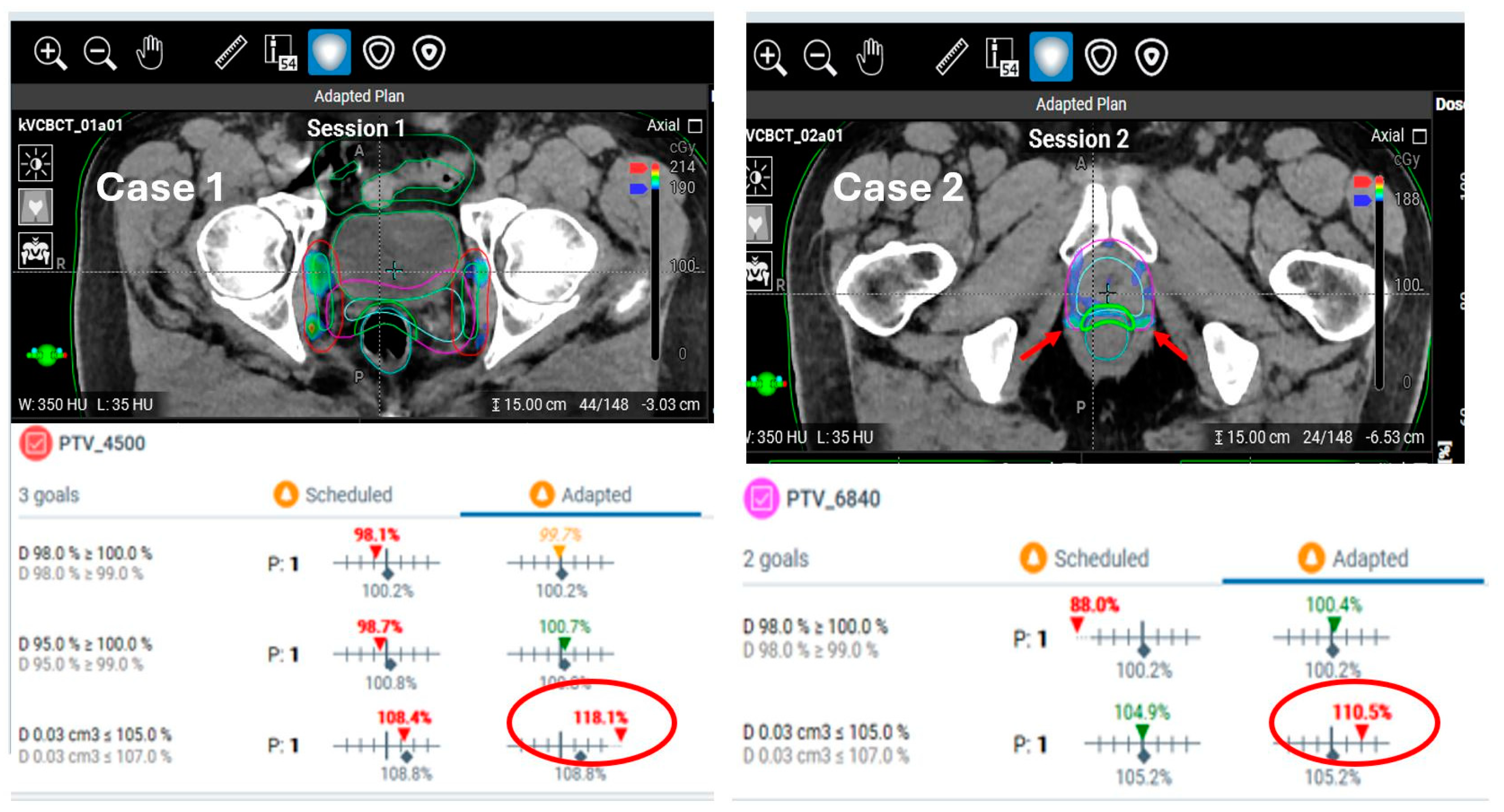 Cancers 17 01462 g009