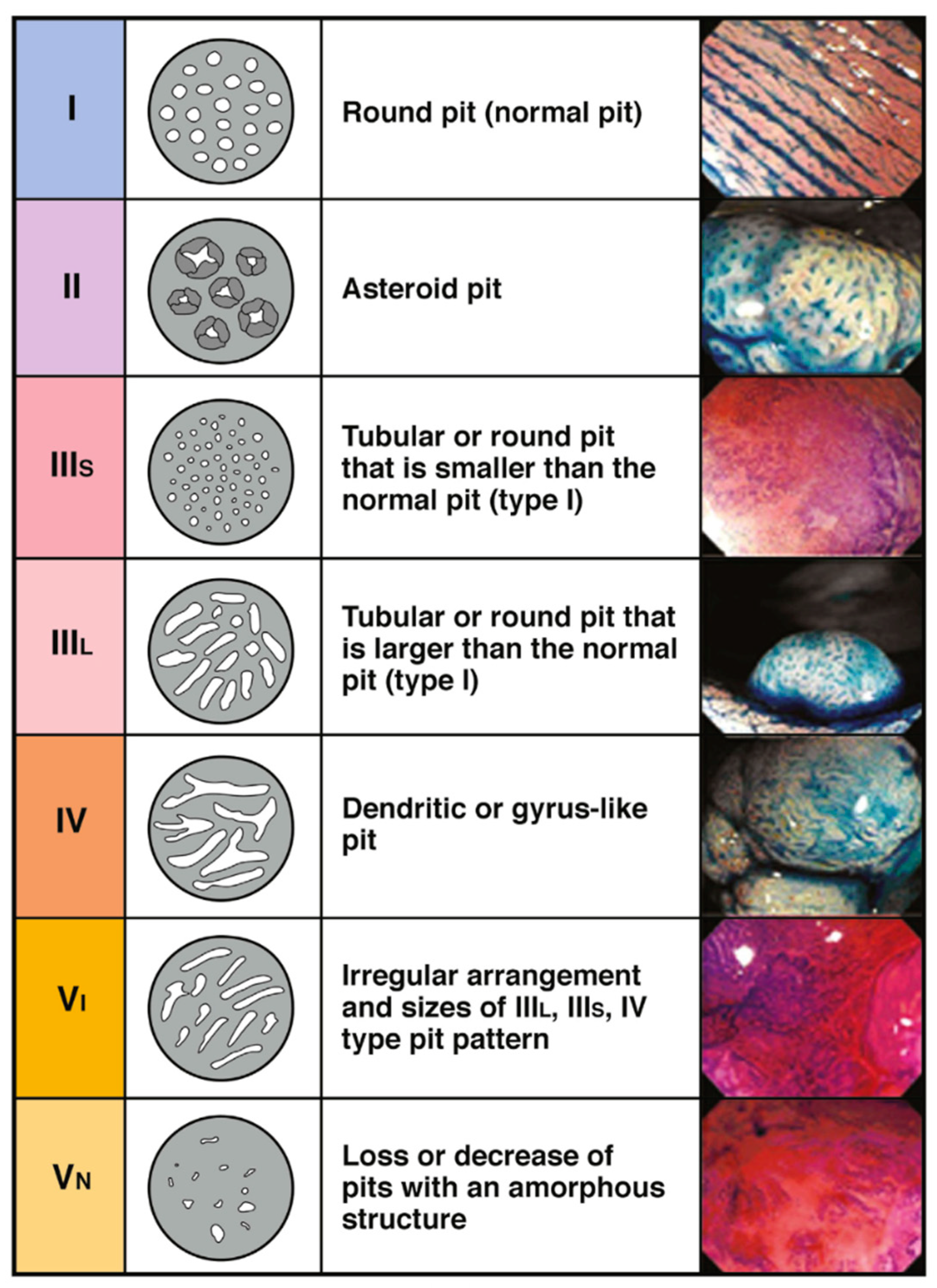 Cancers 17 01464 g002