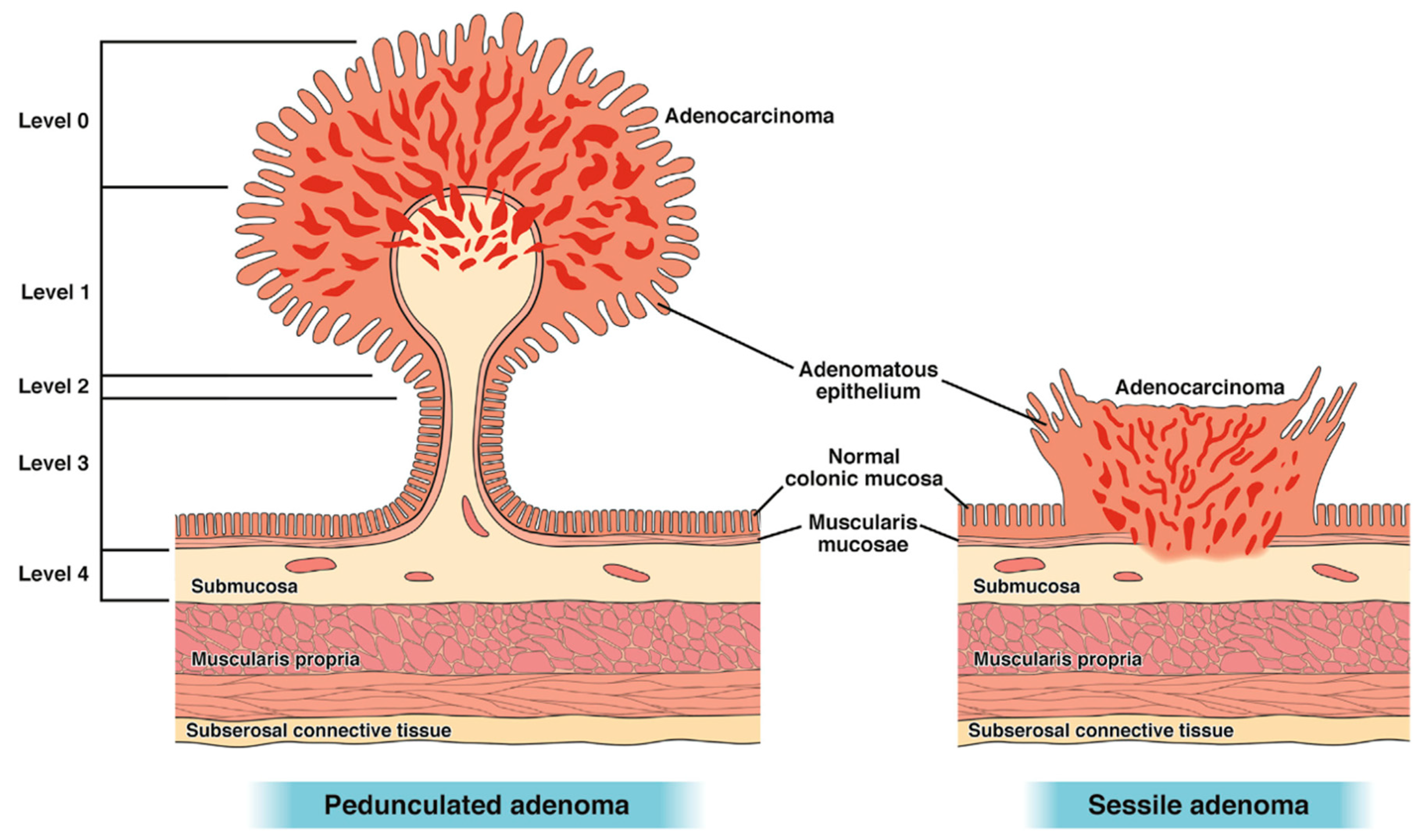 Cancers 17 01464 g003
