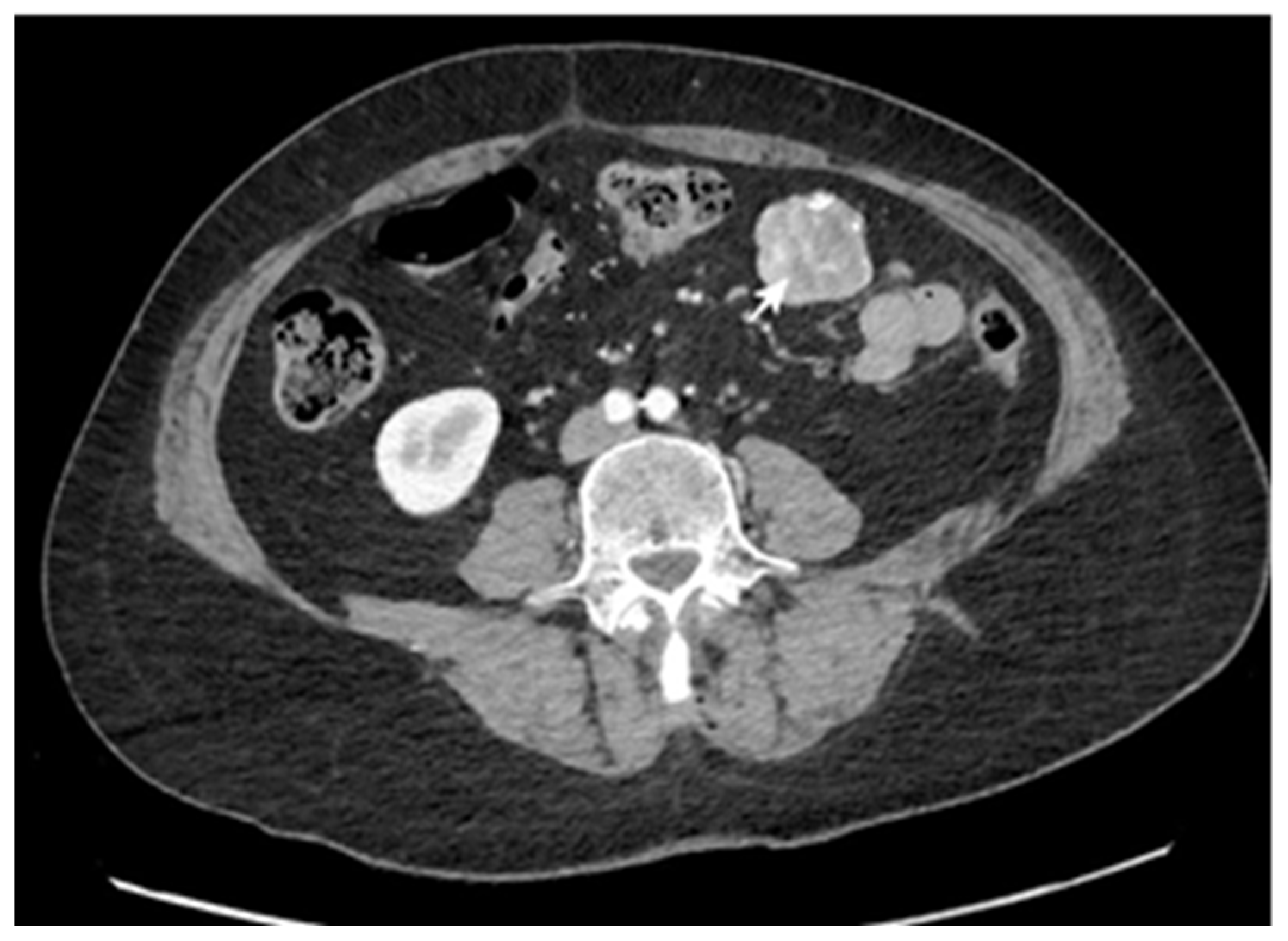 Cancers 17 01465 g002 Cancers 17 01465 g002