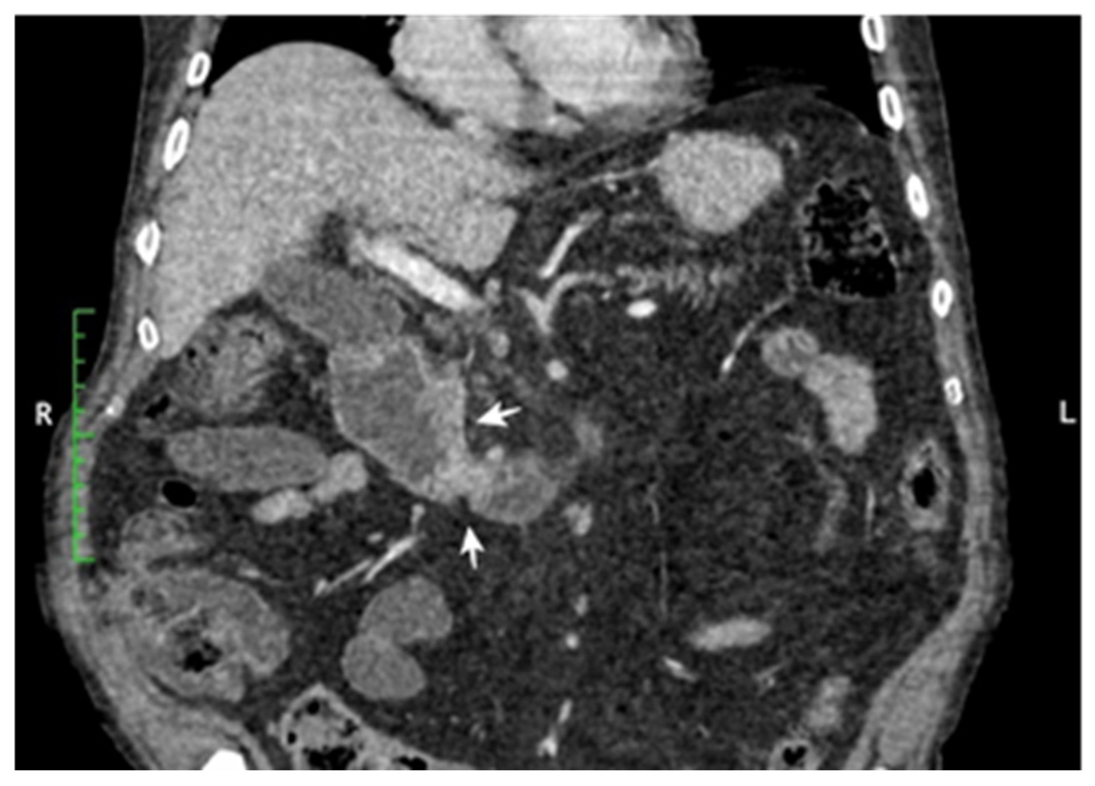 Cancers 17 01465 g003 Cancers 17 01465 g003