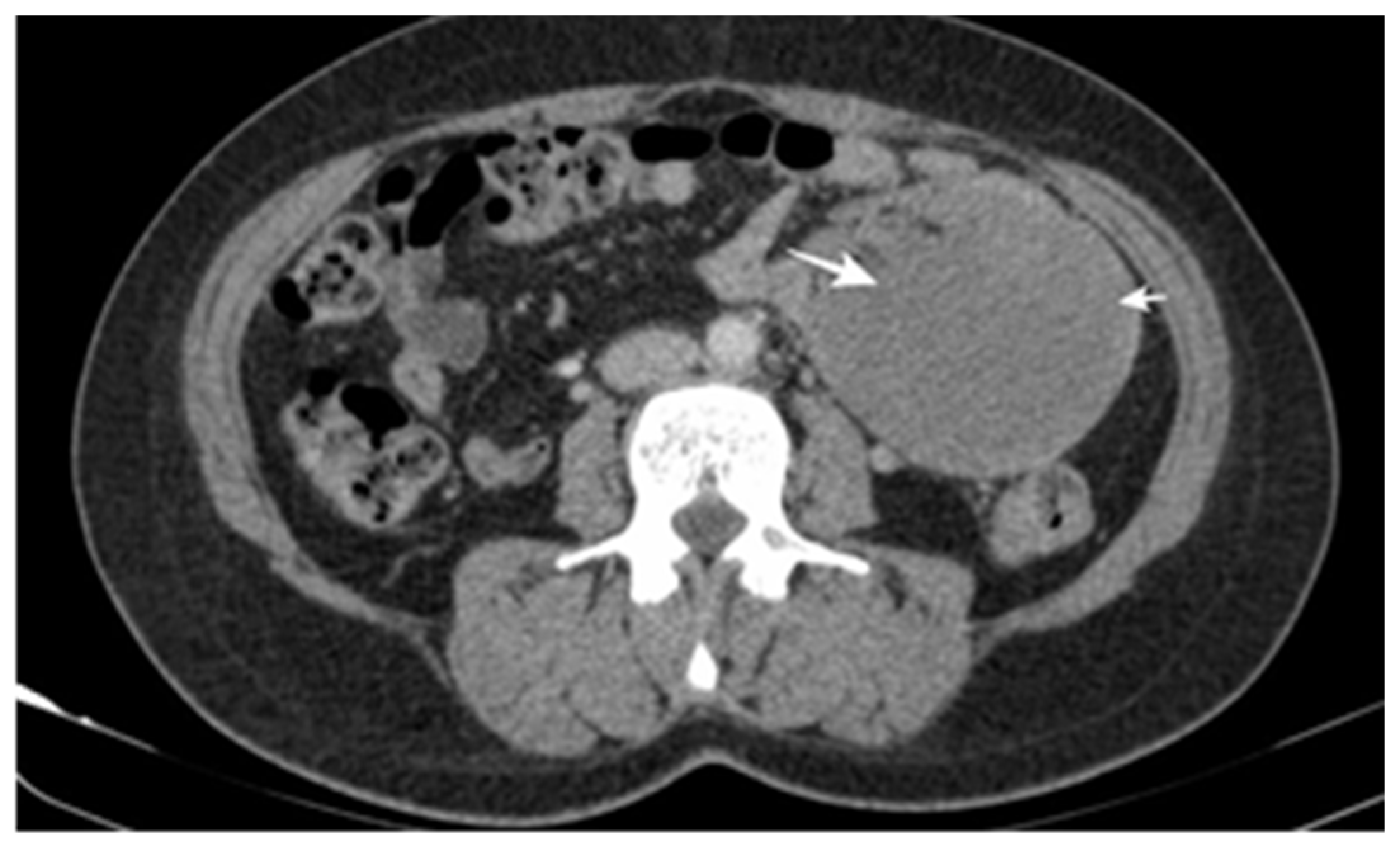 Cancers 17 01465 g005 Cancers 17 01465 g005