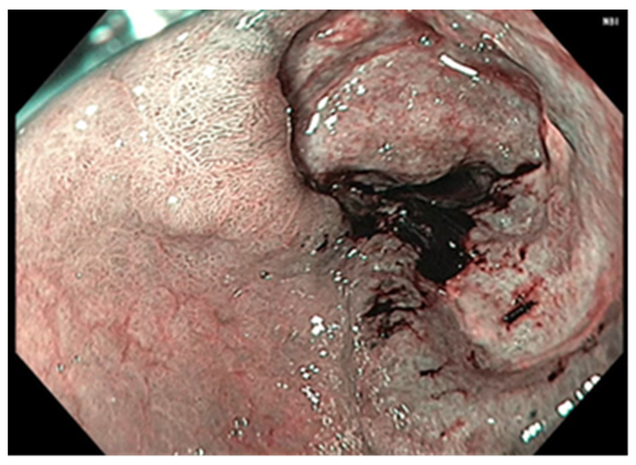 Cancers 17 01465 g006 Cancers 17 01465 g006