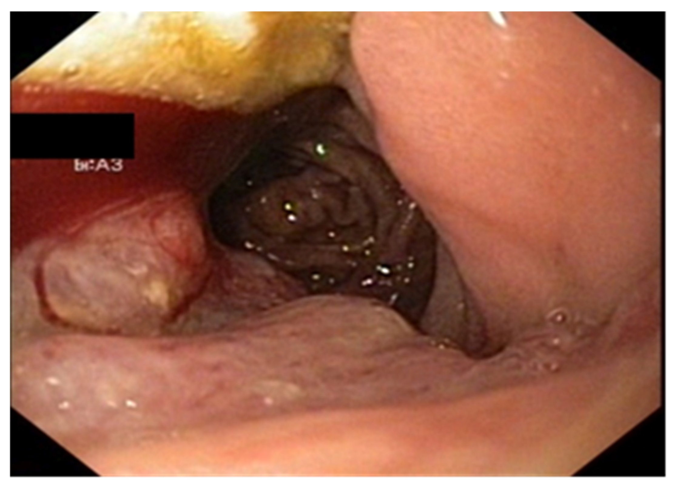 Cancers 17 01465 g007 Cancers 17 01465 g007