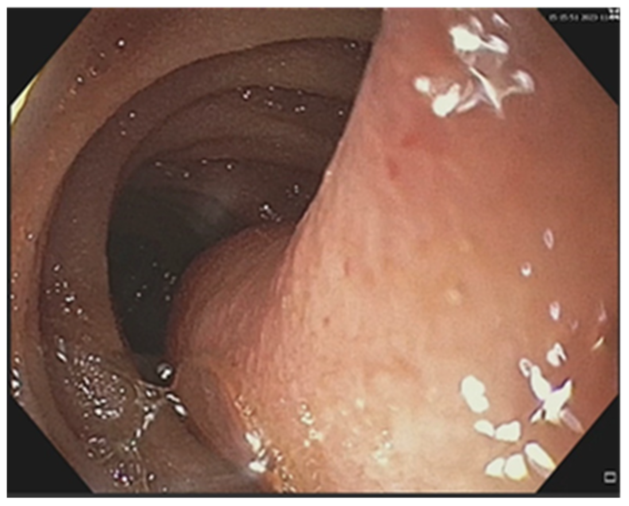 Cancers 17 01465 g008 Cancers 17 01465 g008