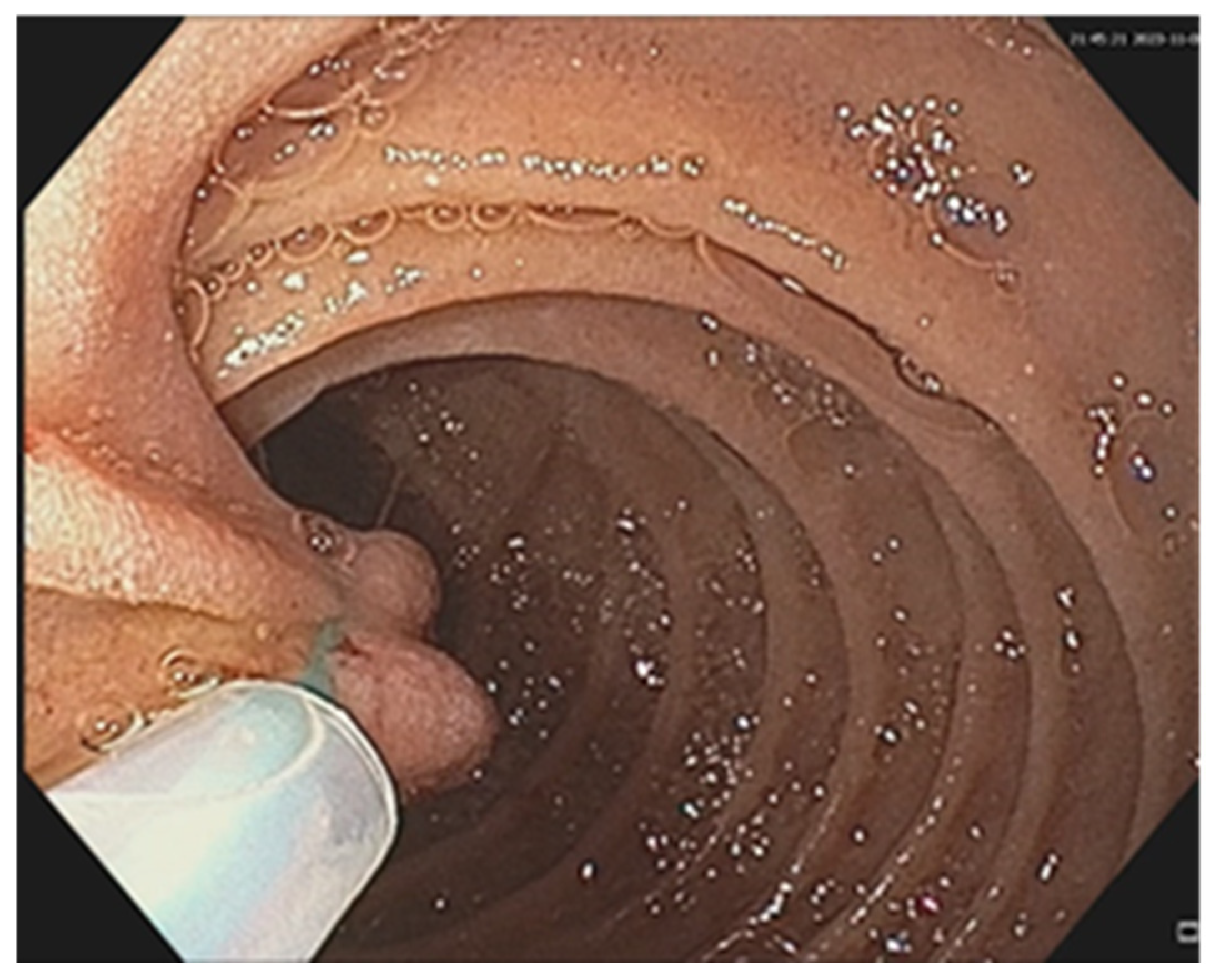 Cancers 17 01465 g009 Cancers 17 01465 g009