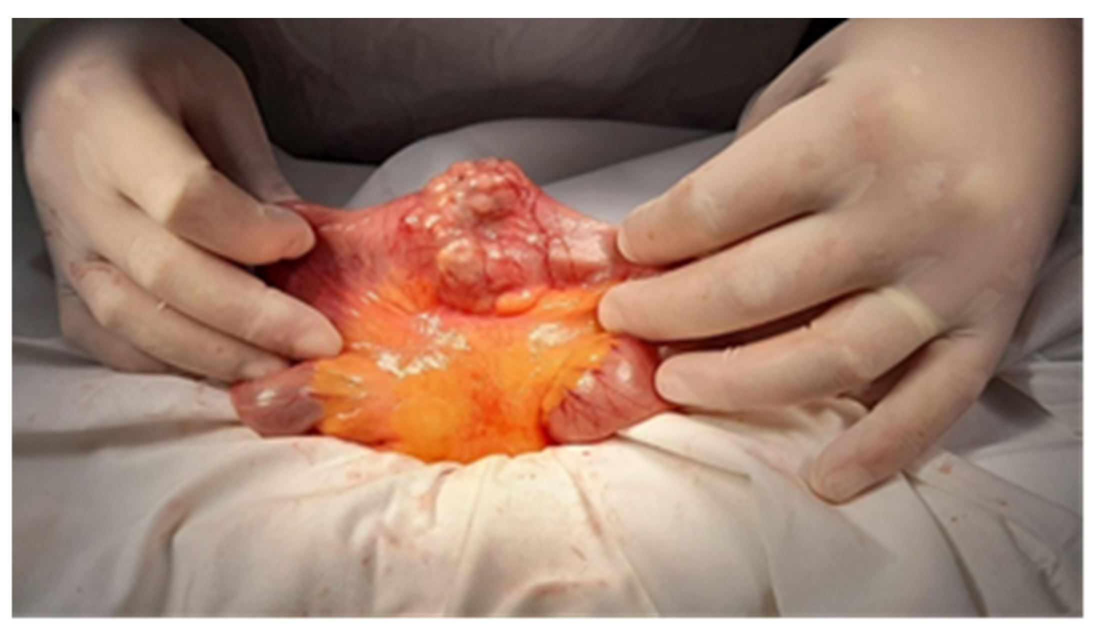 Cancers 17 01465 g010 Cancers 17 01465 g010