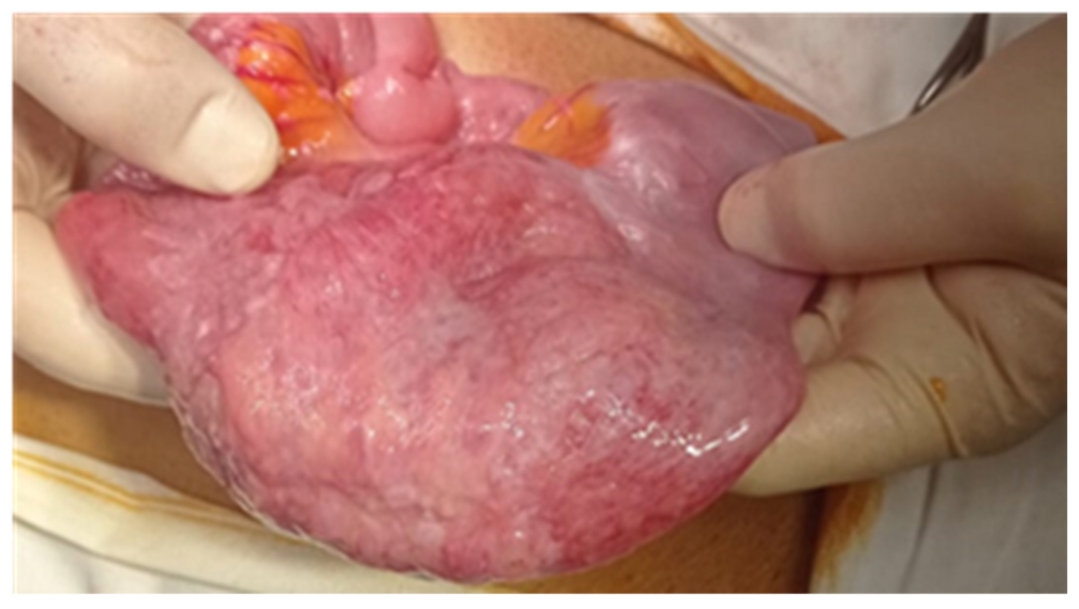 Cancers 17 01465 g011 Cancers 17 01465 g011