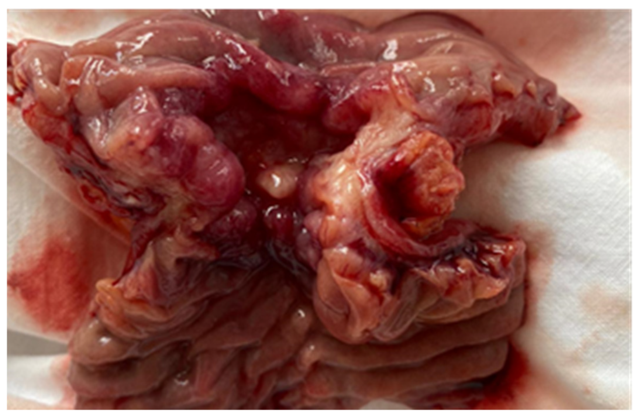 Cancers 17 01465 g012 Cancers 17 01465 g012