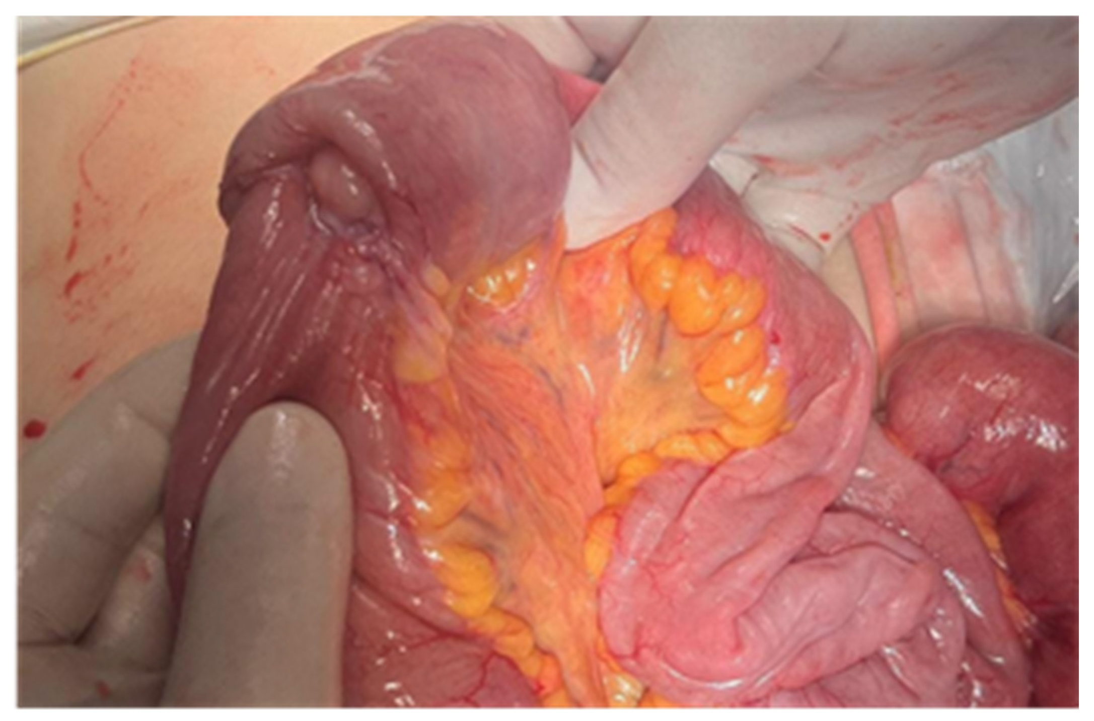 Cancers 17 01465 g013 Cancers 17 01465 g013