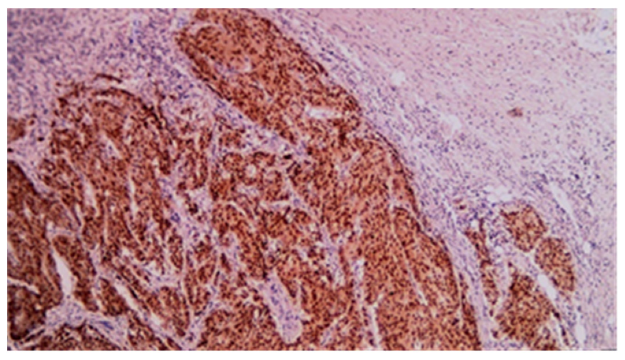 Cancers 17 01465 g014 Cancers 17 01465 g014