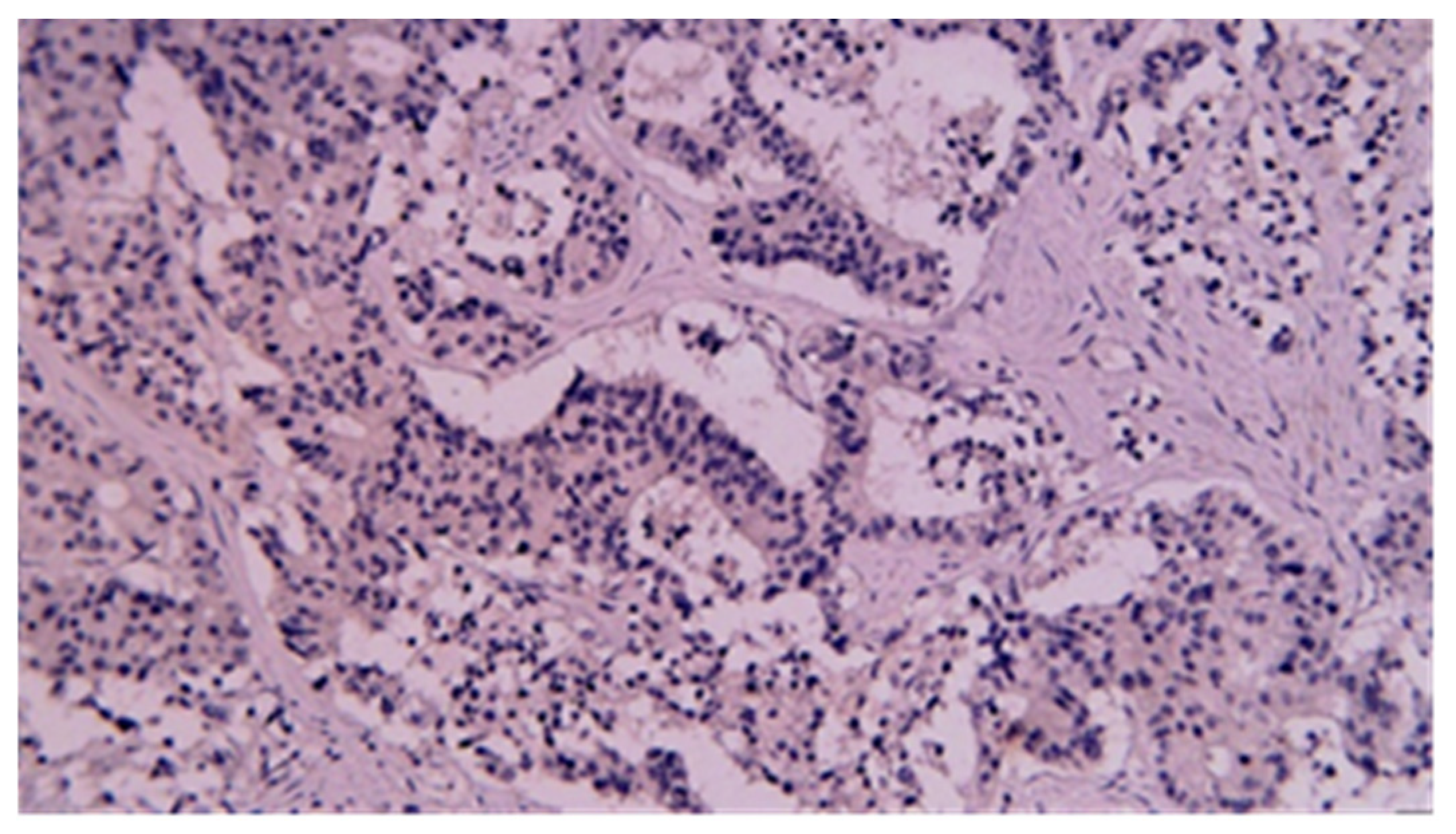 Cancers 17 01465 g015 Cancers 17 01465 g015