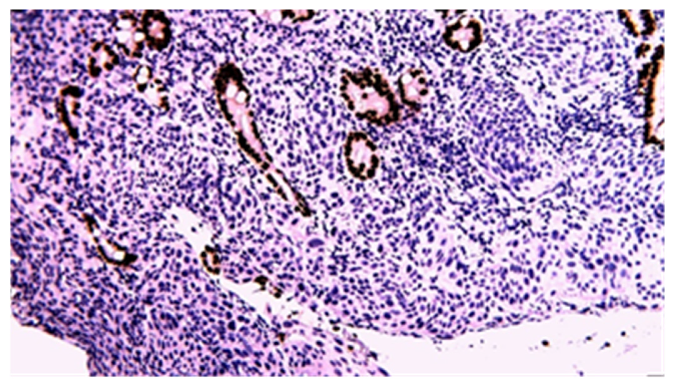 Cancers 17 01465 g016 Cancers 17 01465 g016