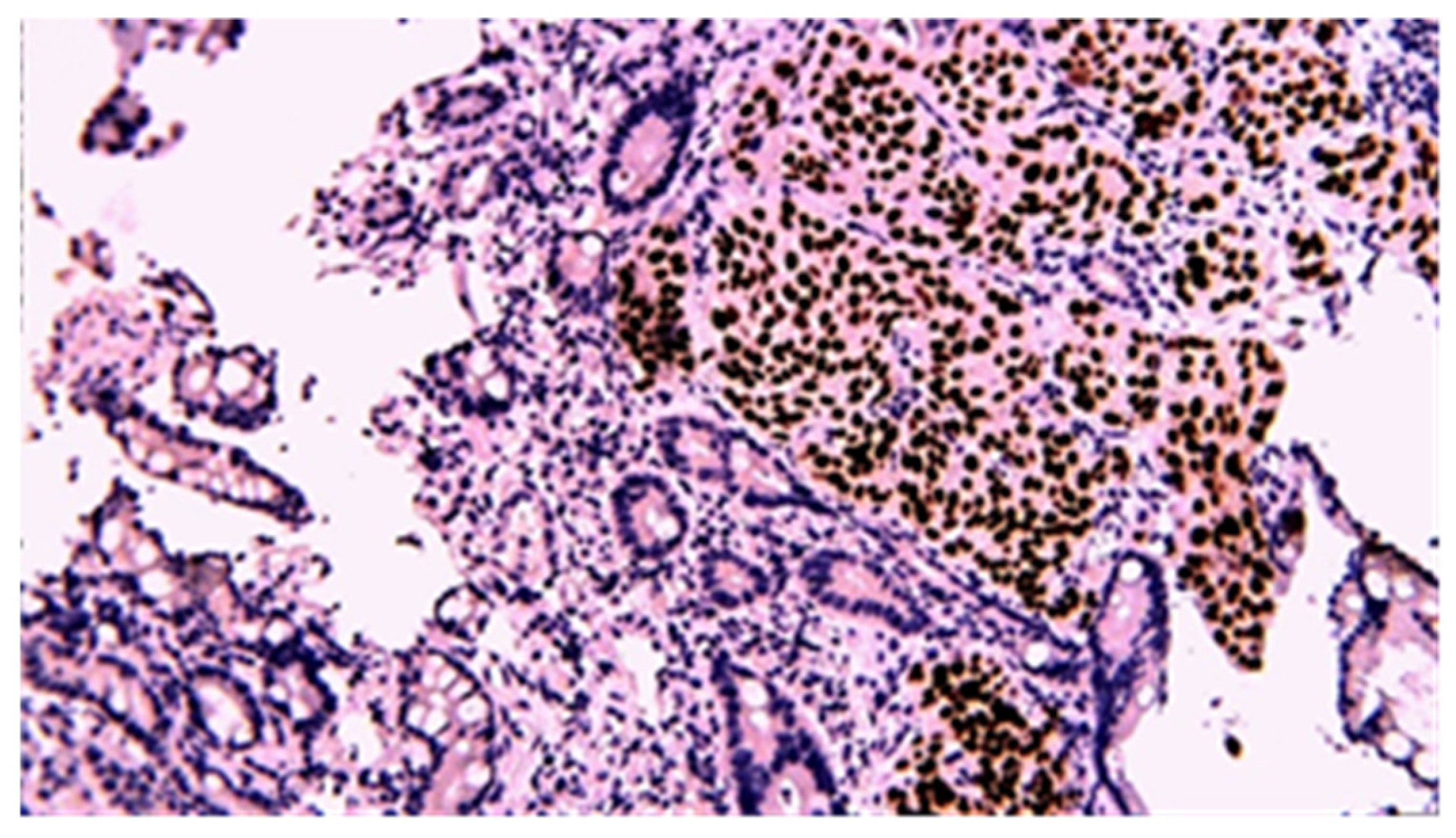 Cancers 17 01465 g017 Cancers 17 01465 g017