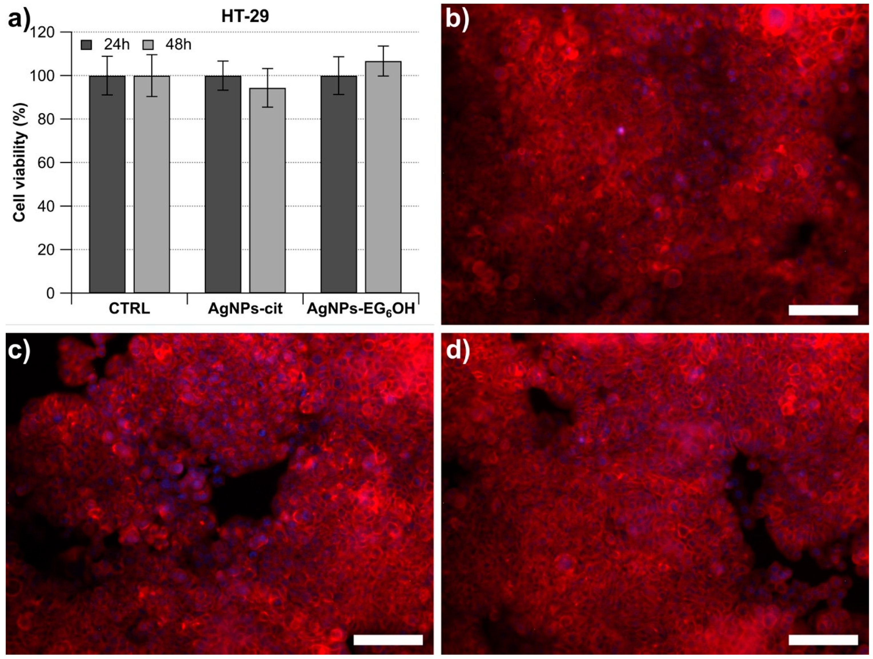 Cancers 17 01475 g003