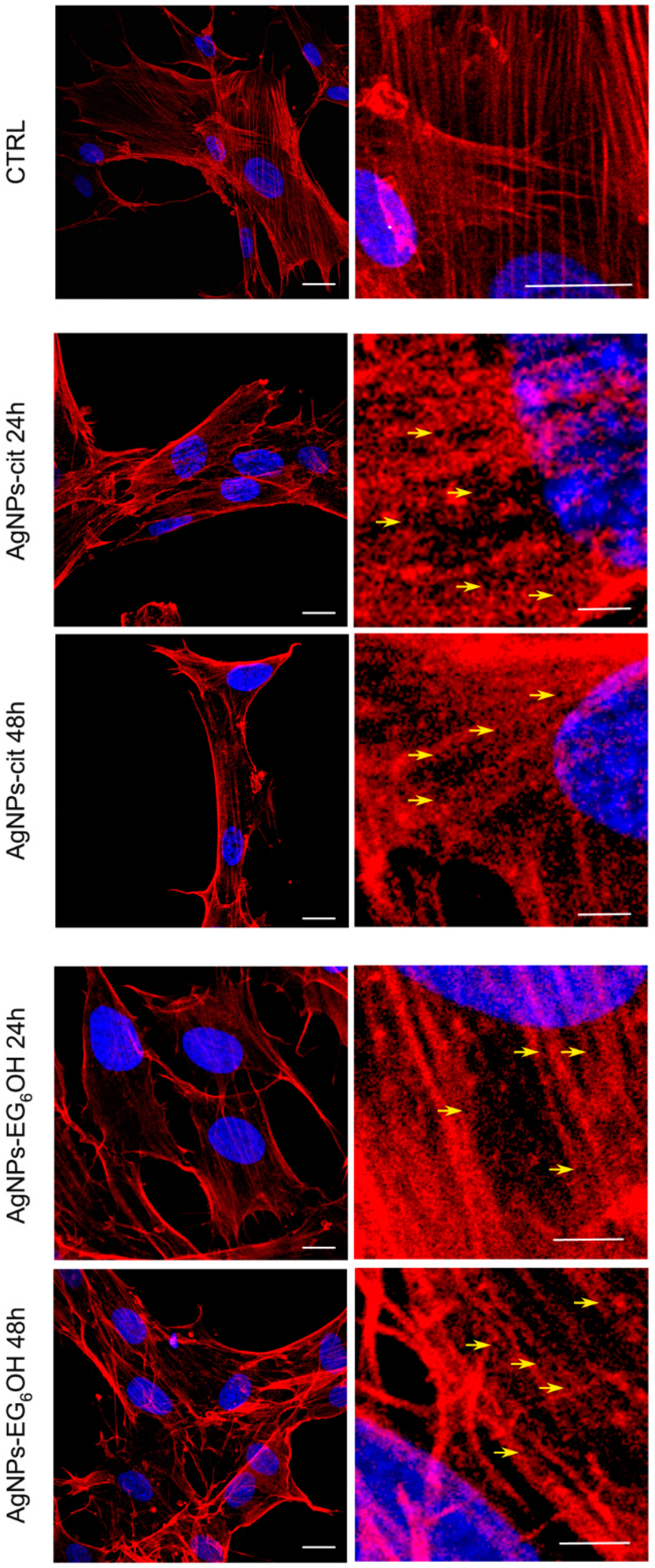 Cancers 17 01475 g006