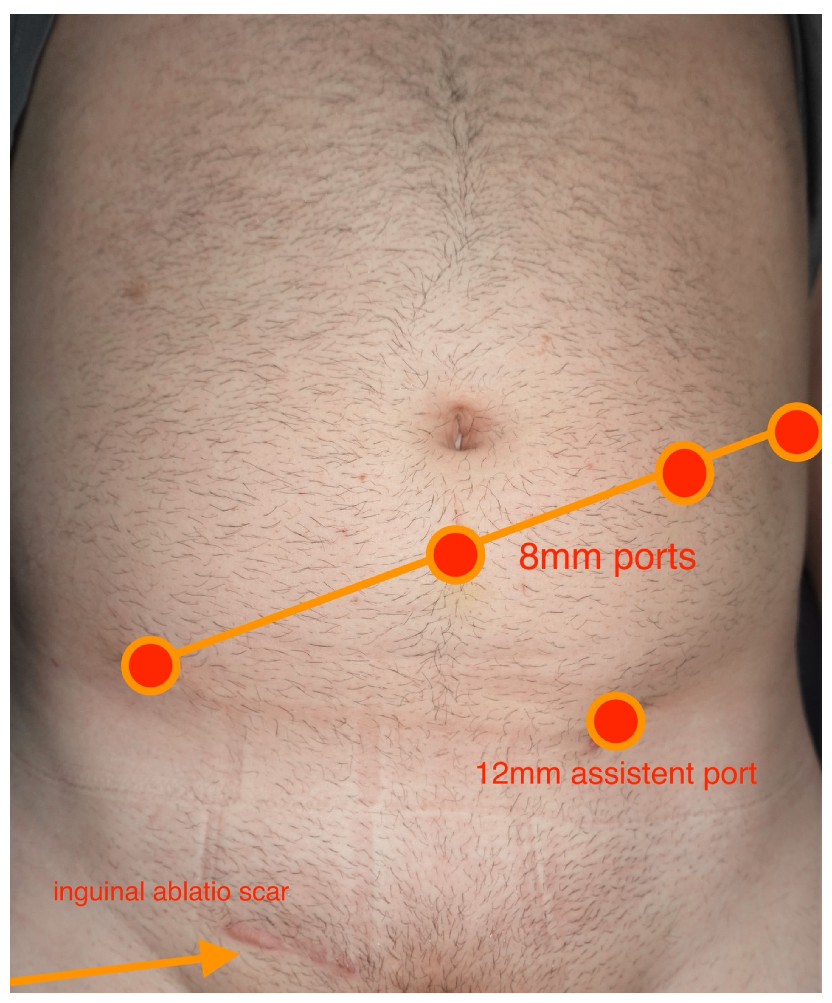 Cancers 17 01476 g001